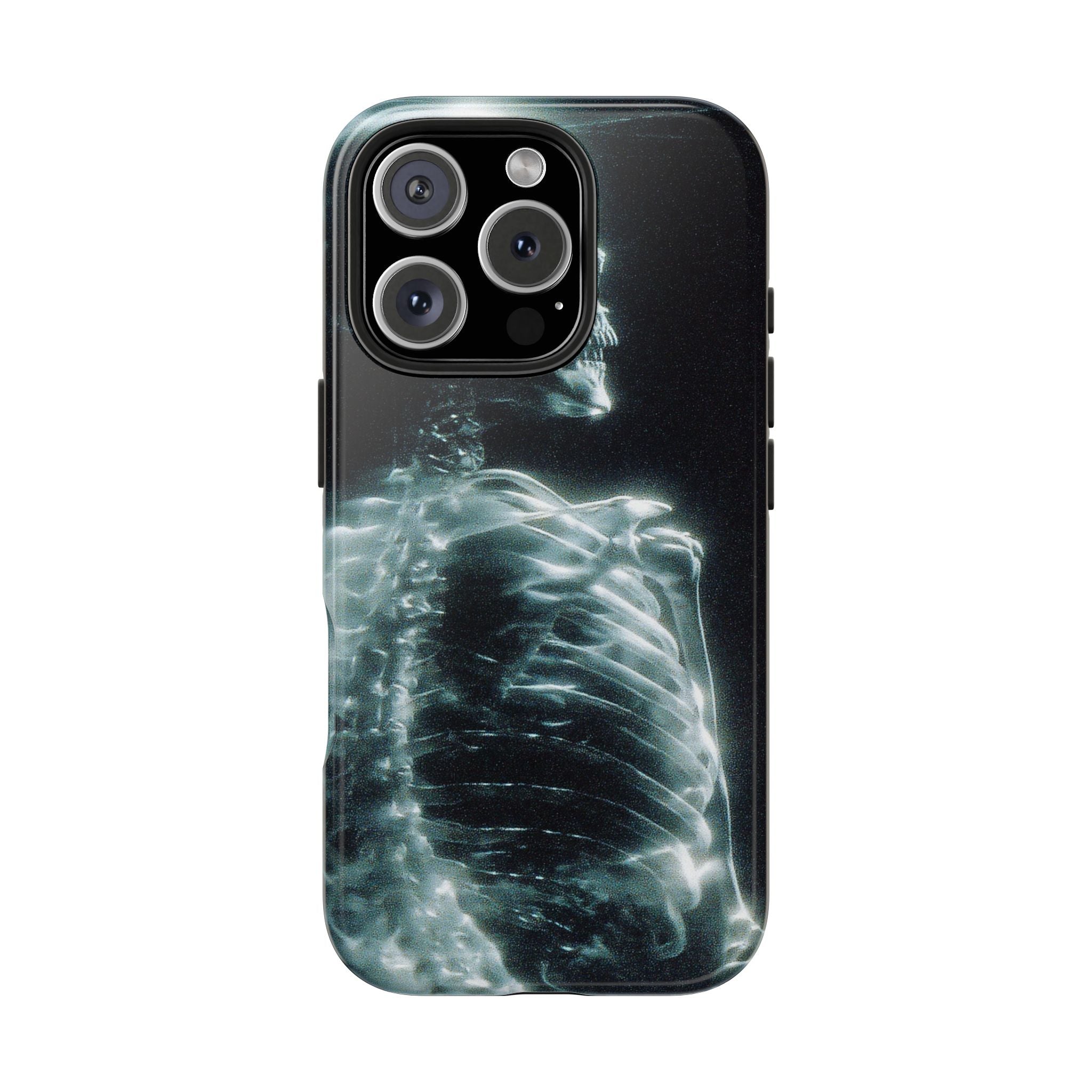 X ray phone case