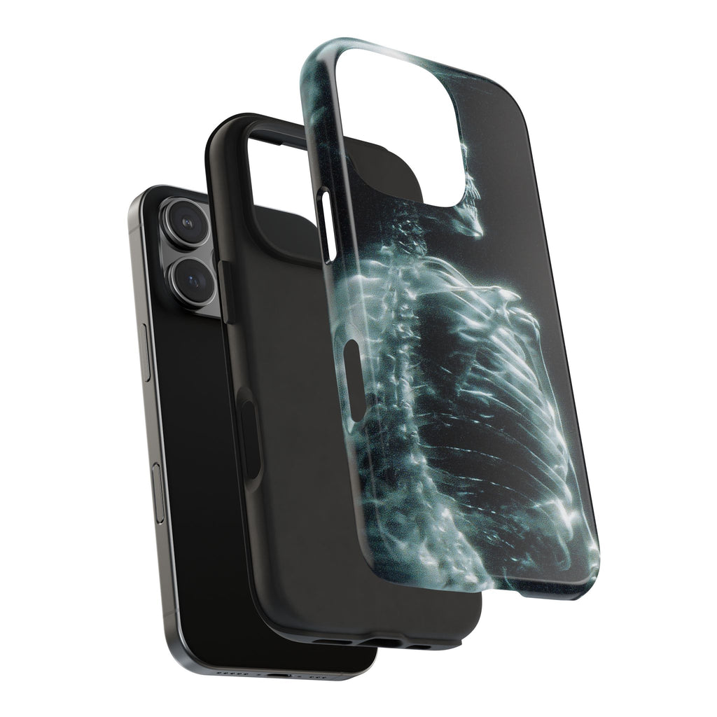 X ray phone case