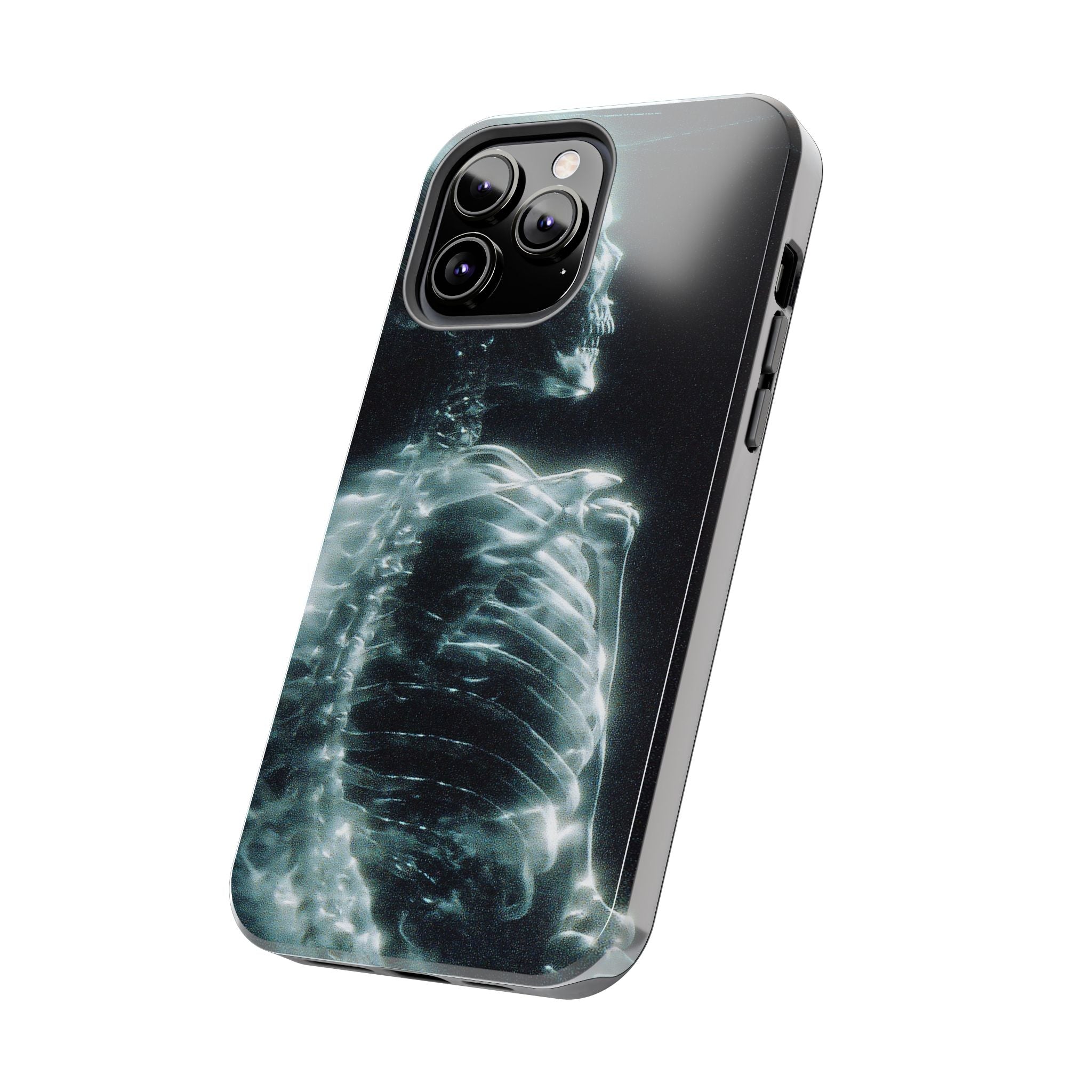 X ray phone case