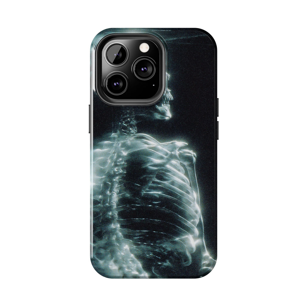X ray phone case
