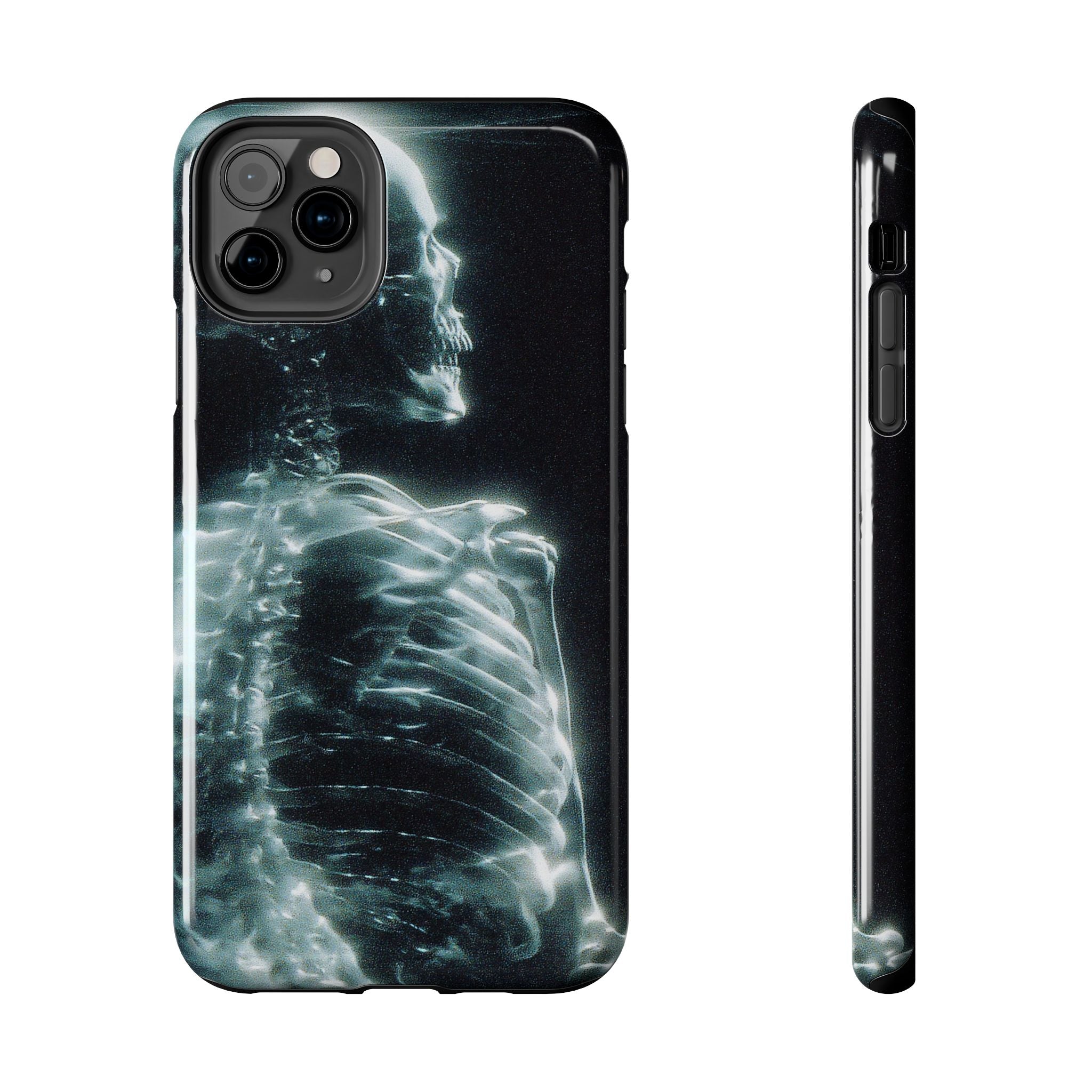 X ray phone case