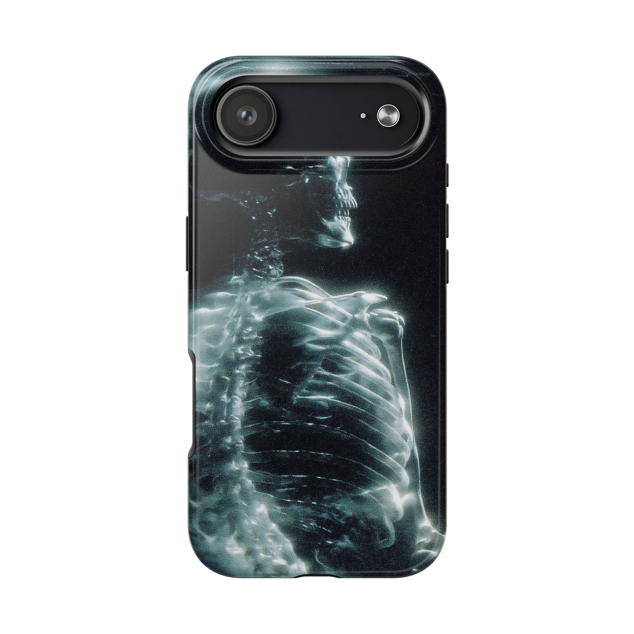 X ray phone case