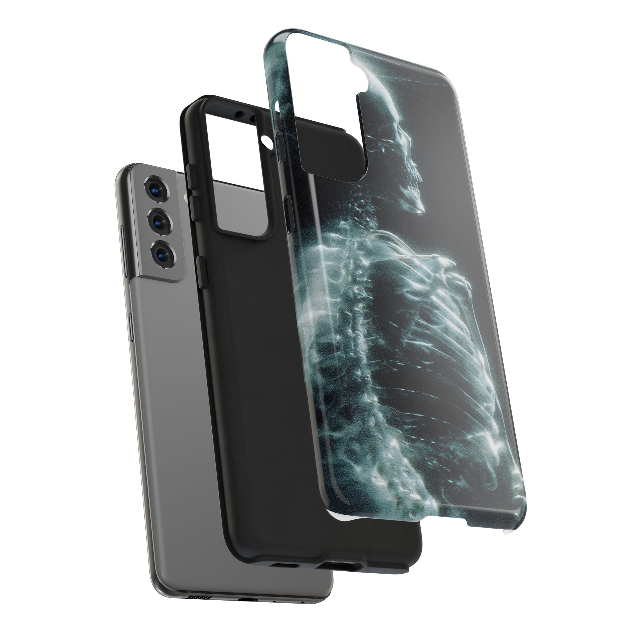 X ray phone case