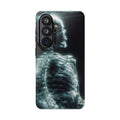 X ray phone case