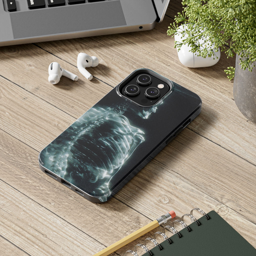 X ray phone case