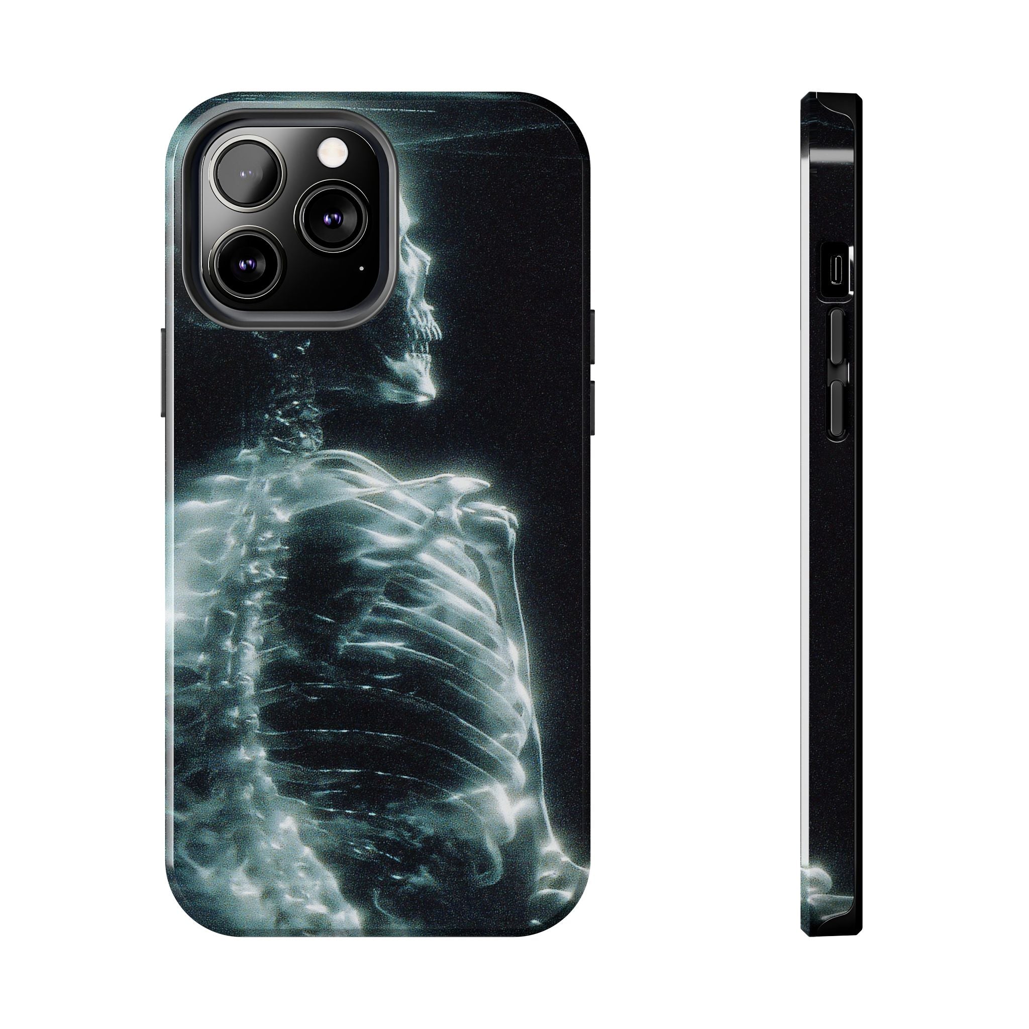 X ray phone case