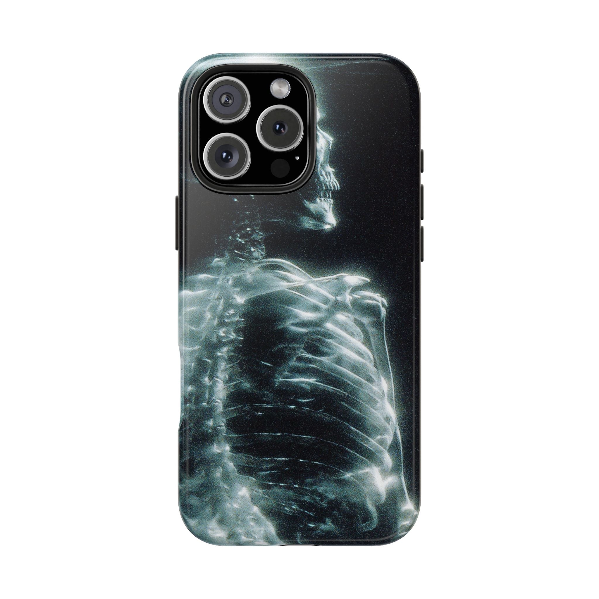 X ray phone case