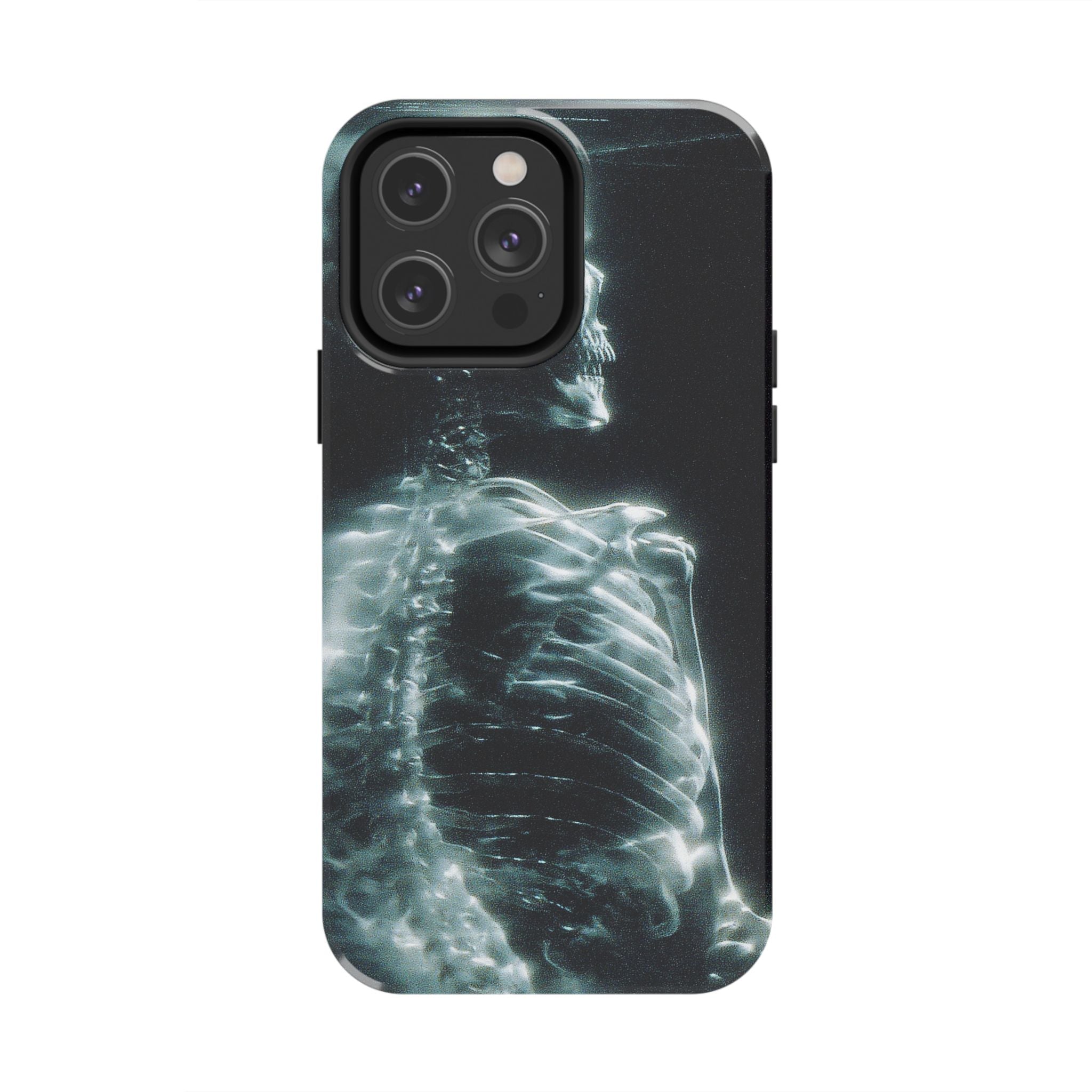 X ray phone case