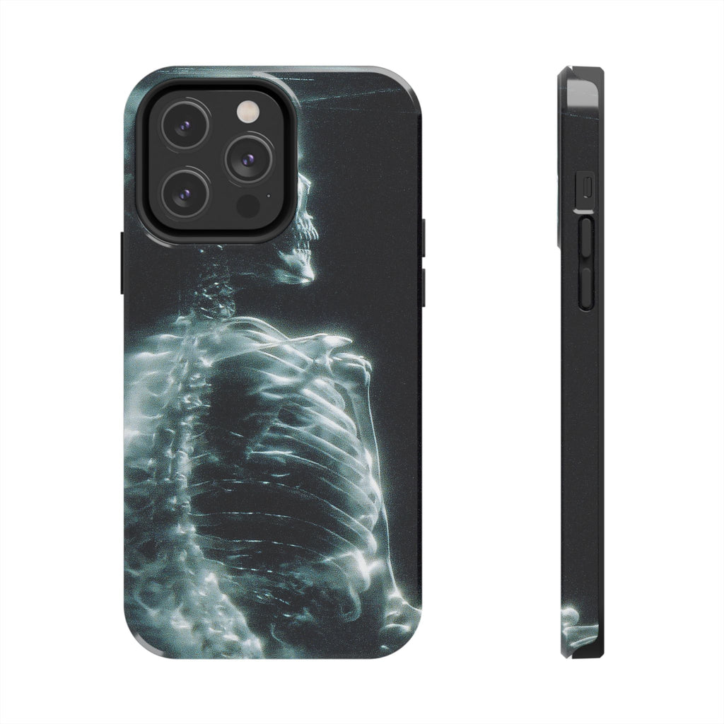 X ray phone case