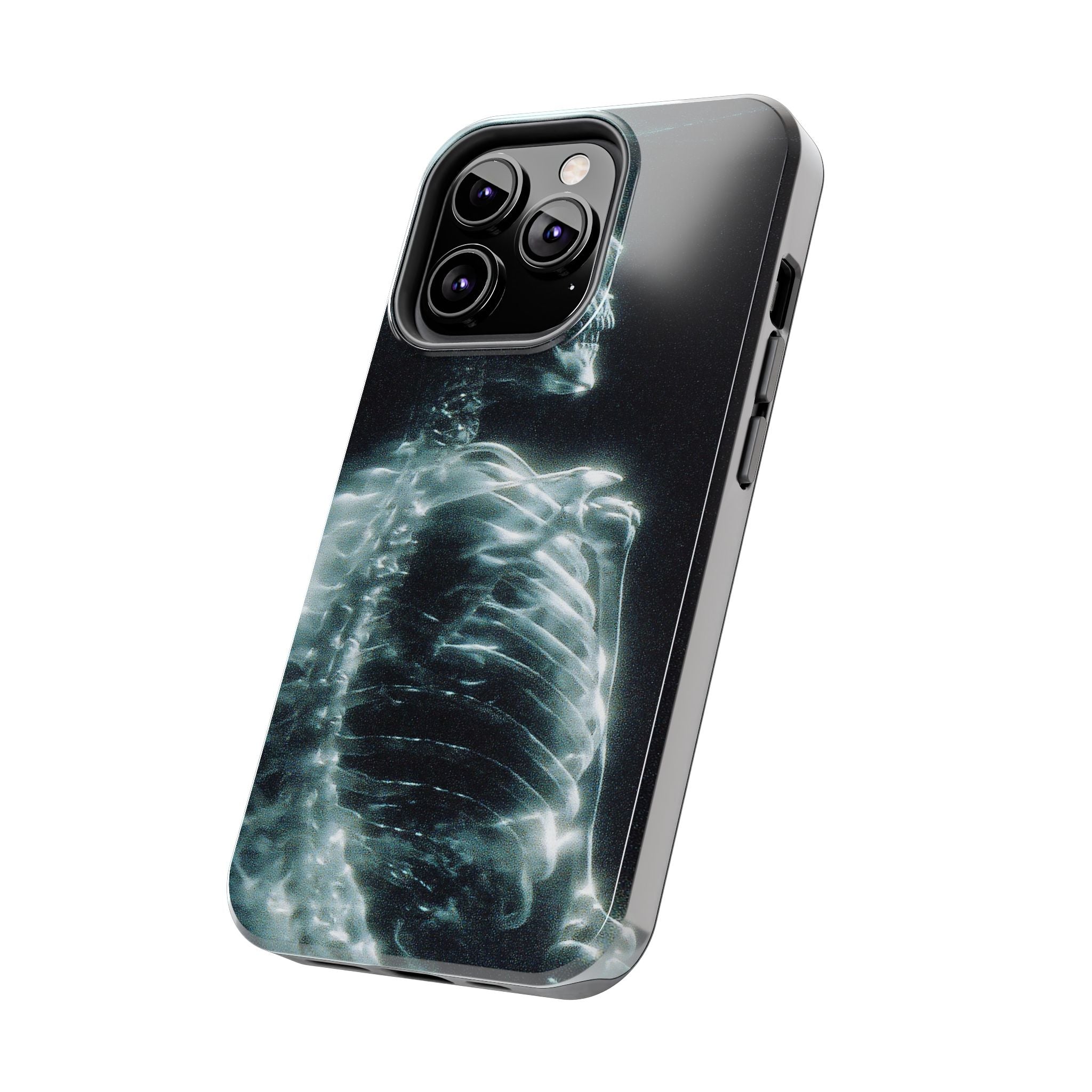X ray phone case