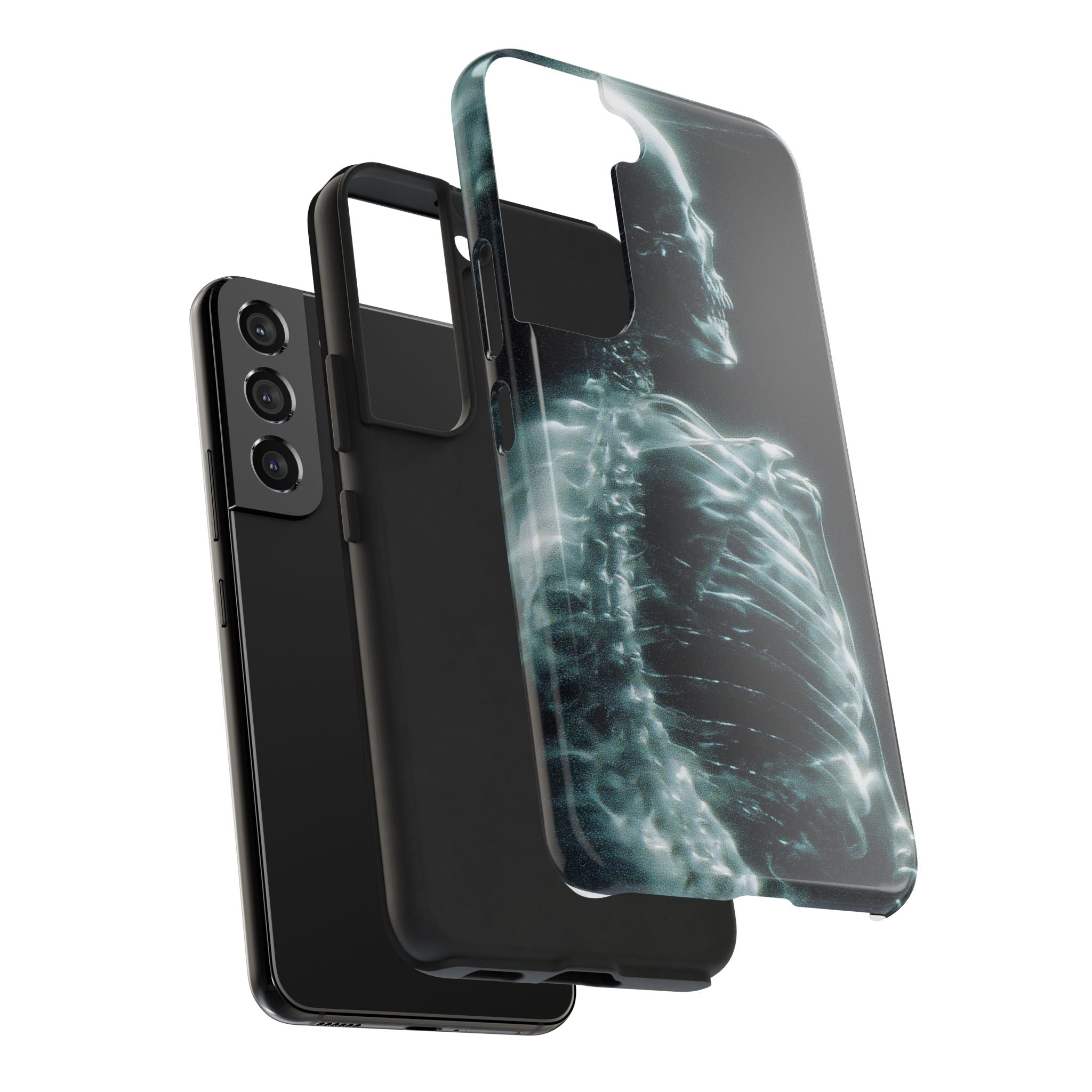 X ray phone case