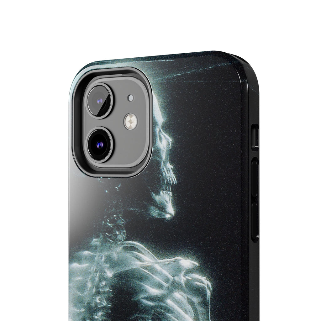 X ray phone case