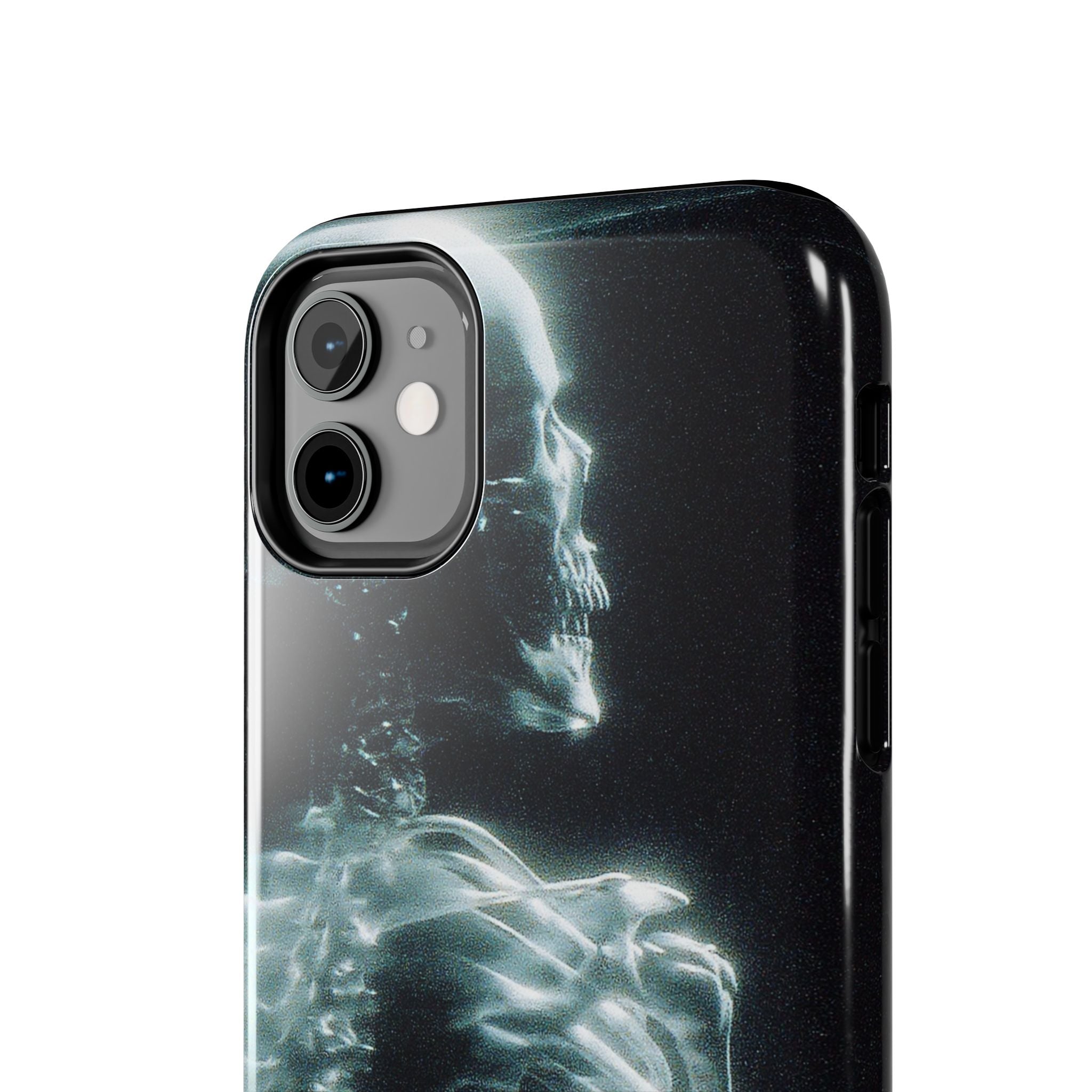 X ray phone case