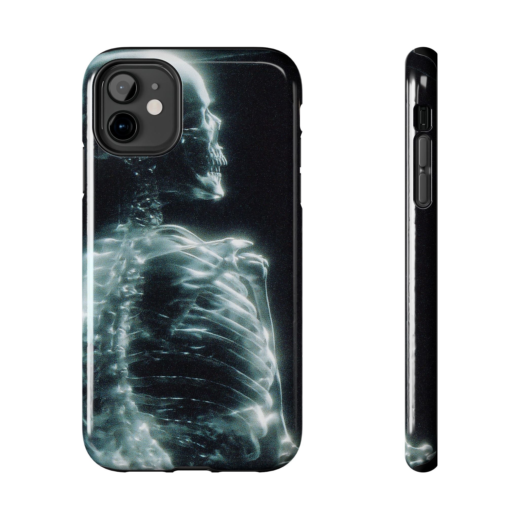 X ray phone case