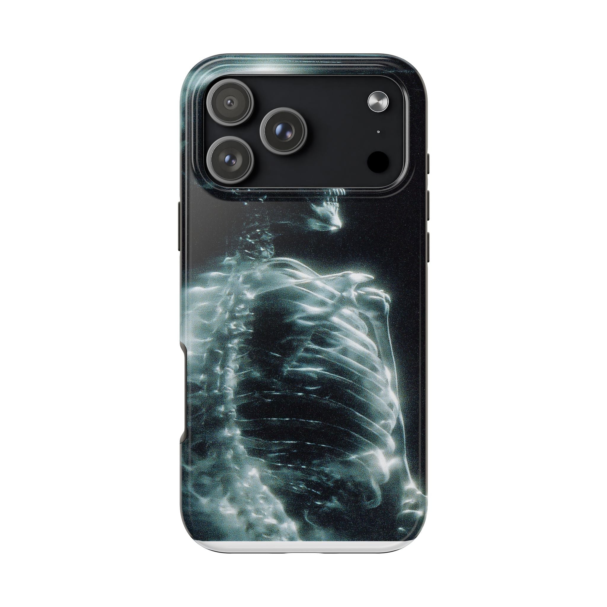 X ray phone case