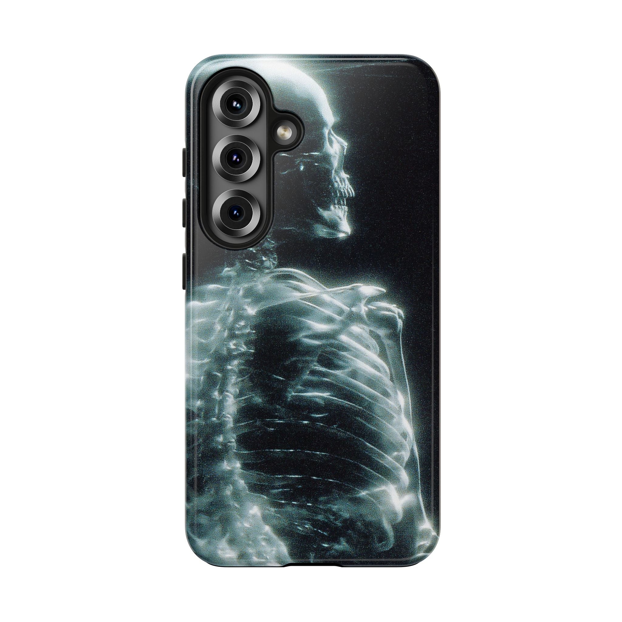 X ray phone case