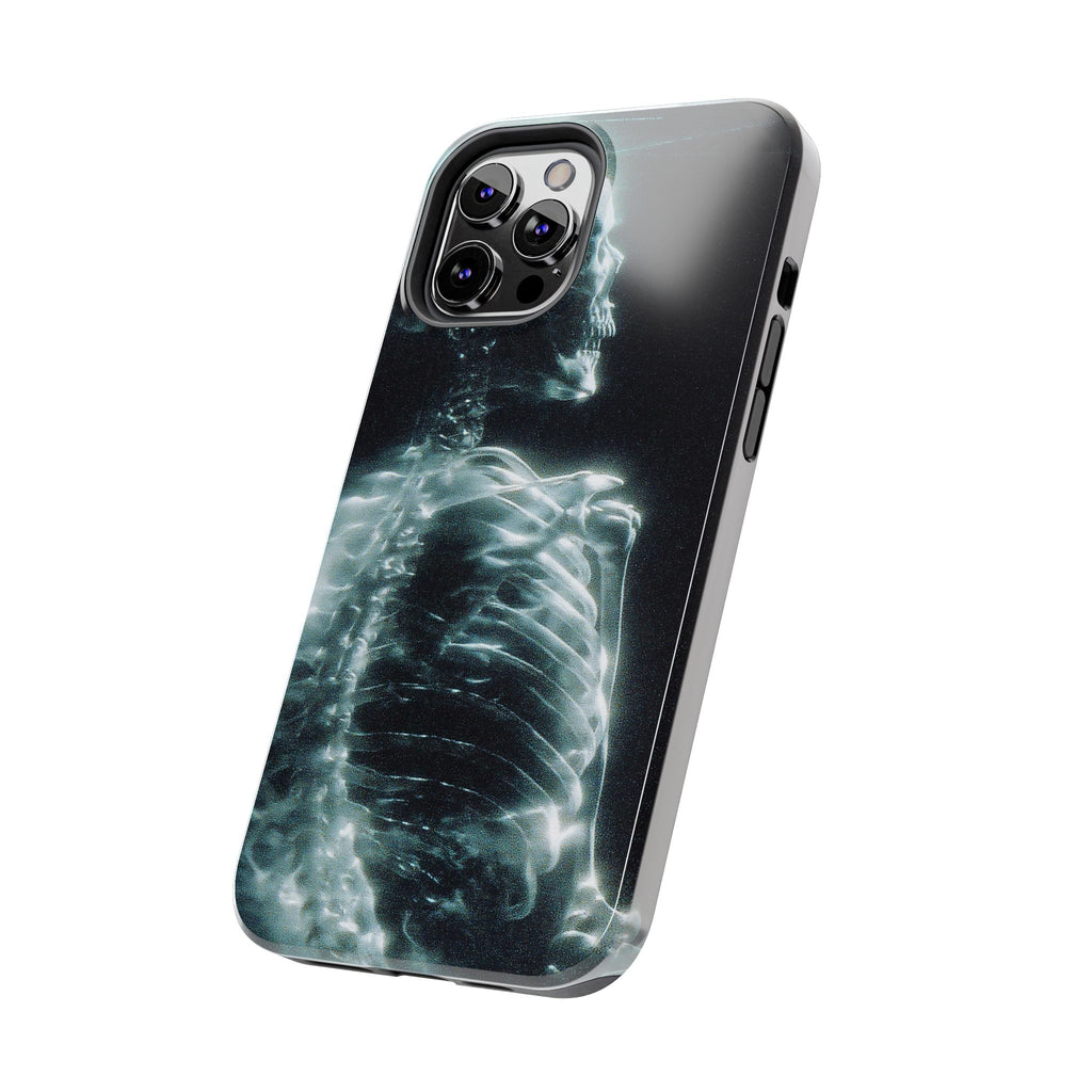 X ray phone case