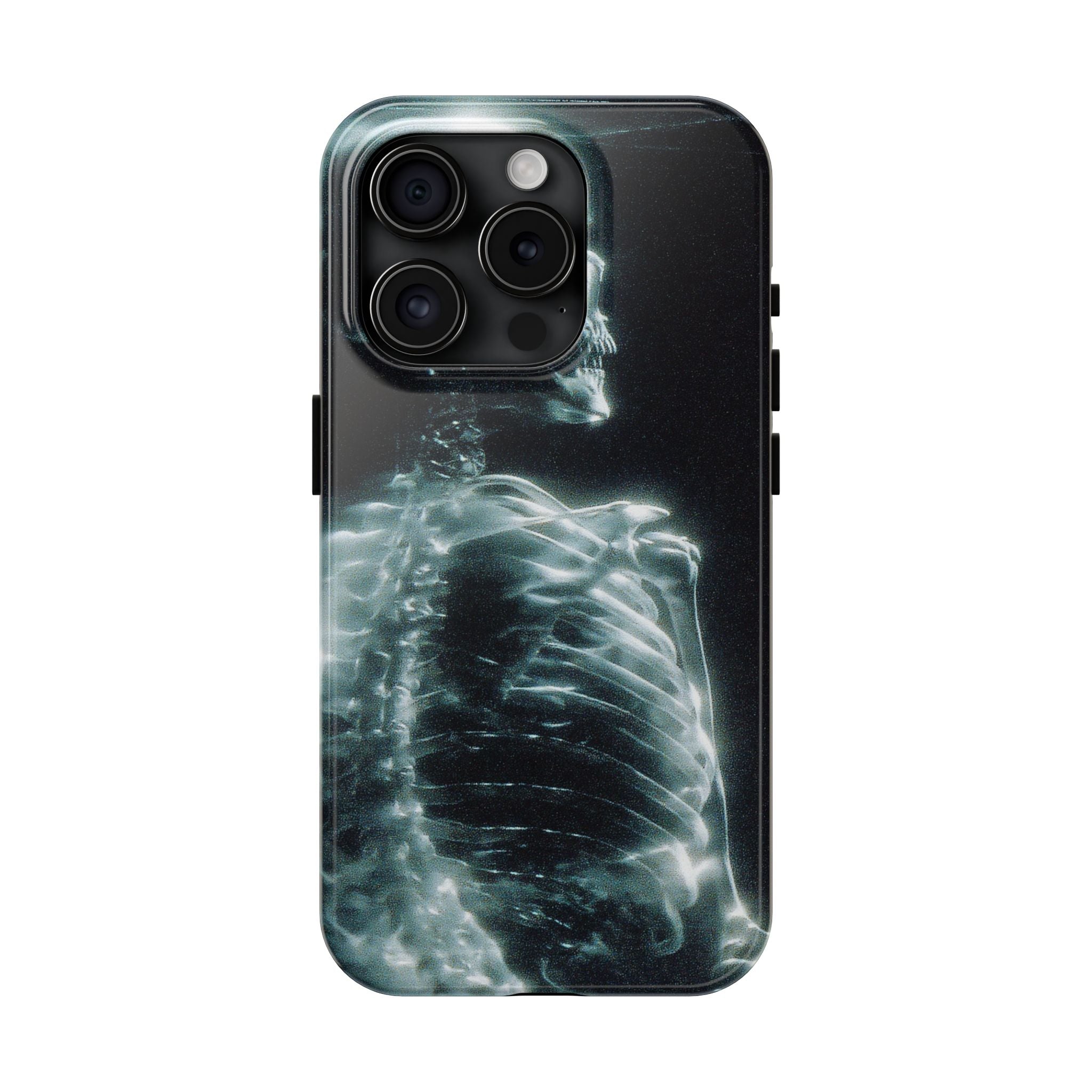 X ray phone case