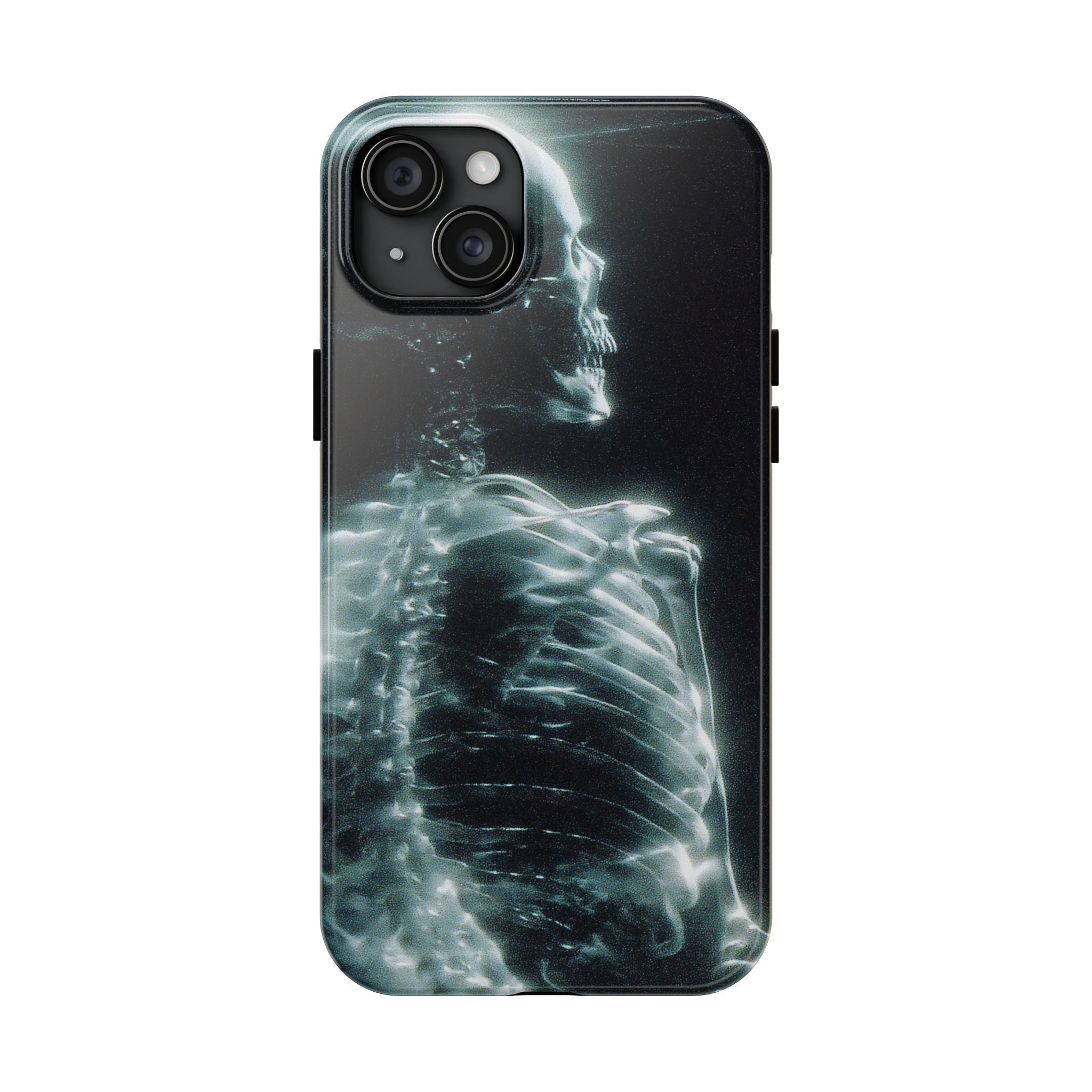 X ray phone case