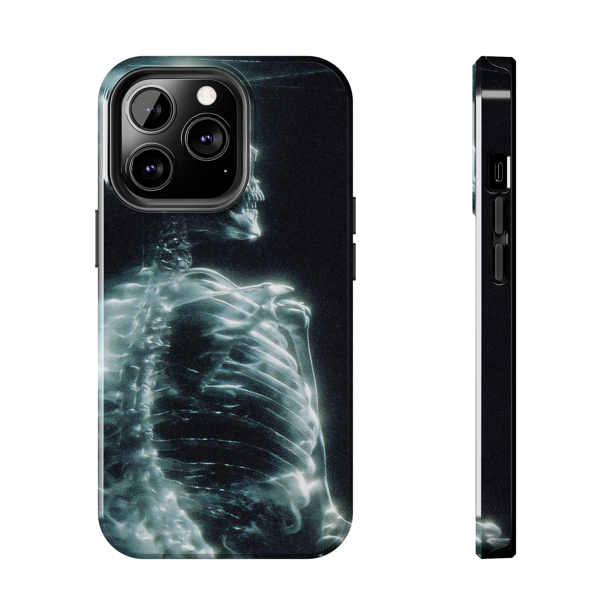 X ray phone case