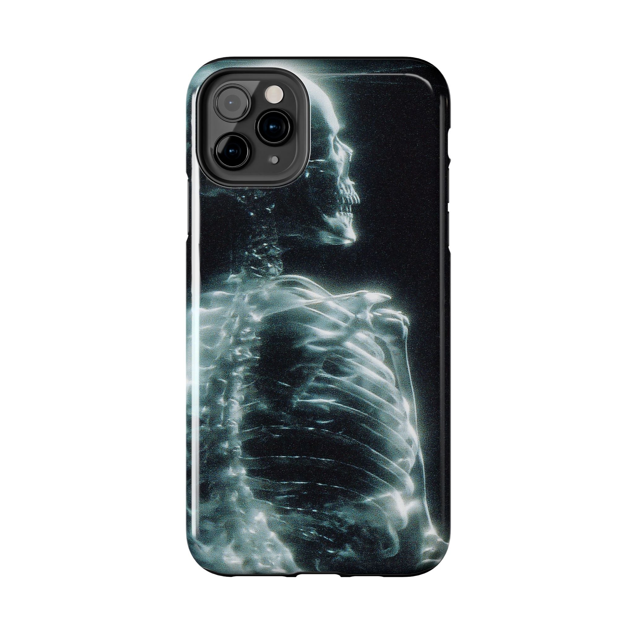 X ray phone case