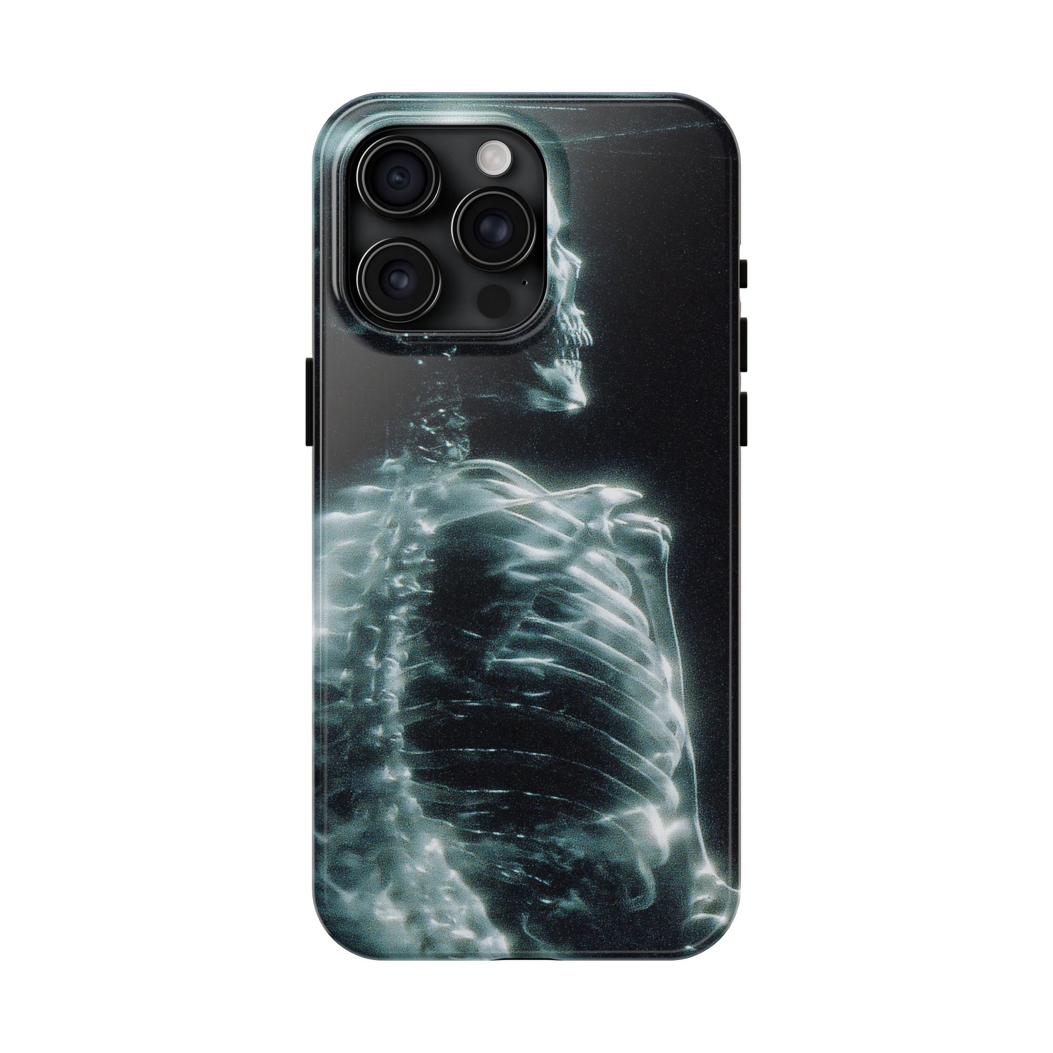X ray phone case