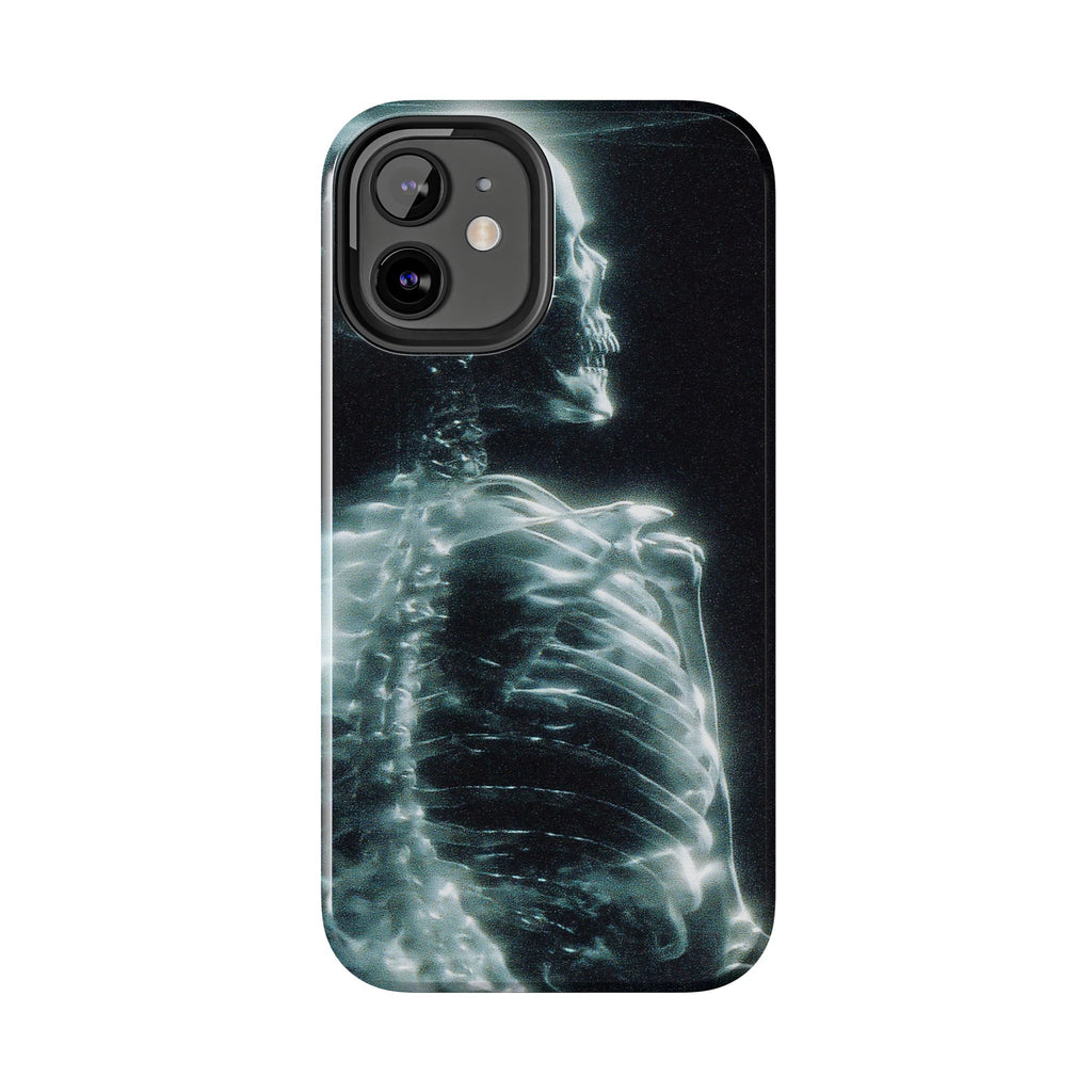 X ray phone case