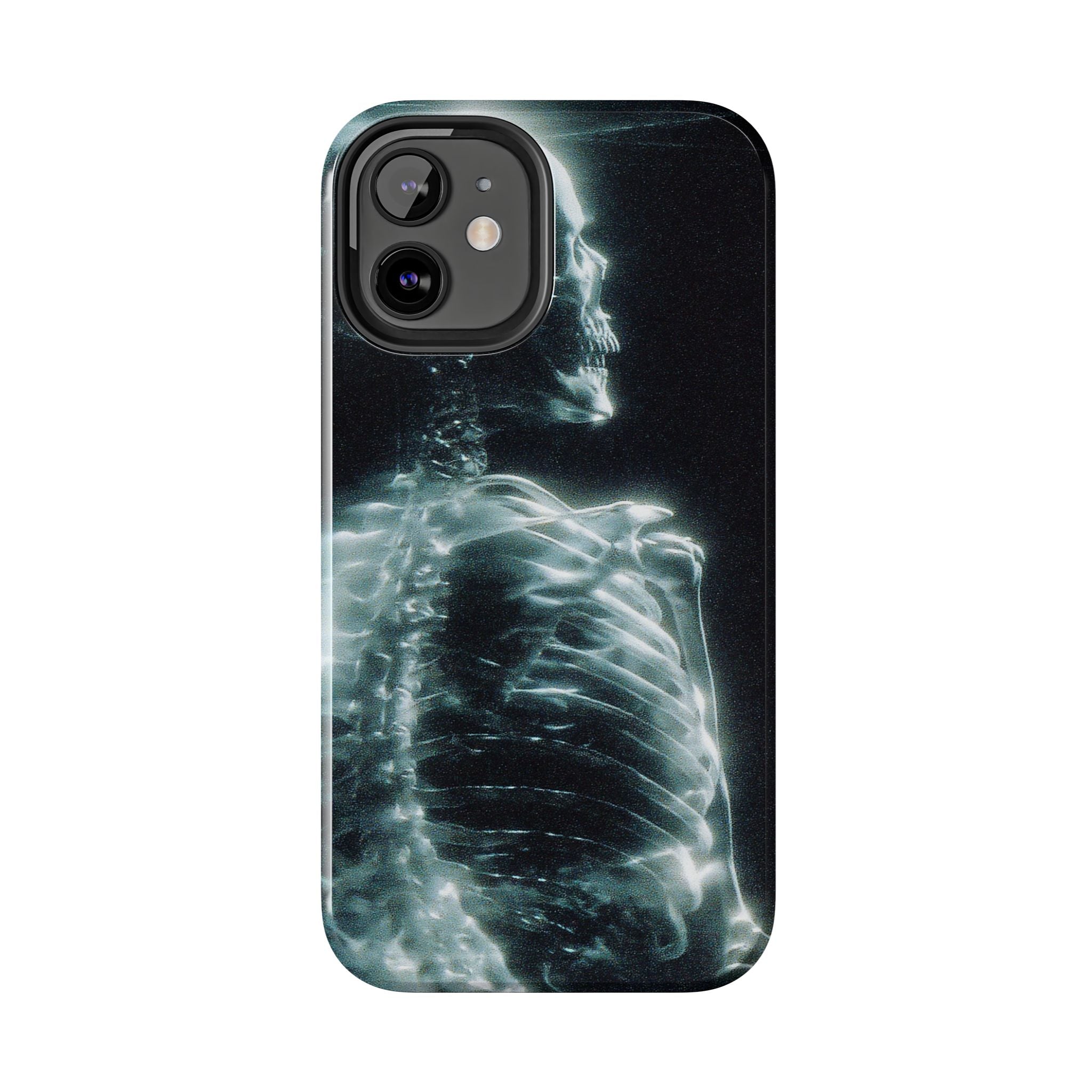 X ray phone case