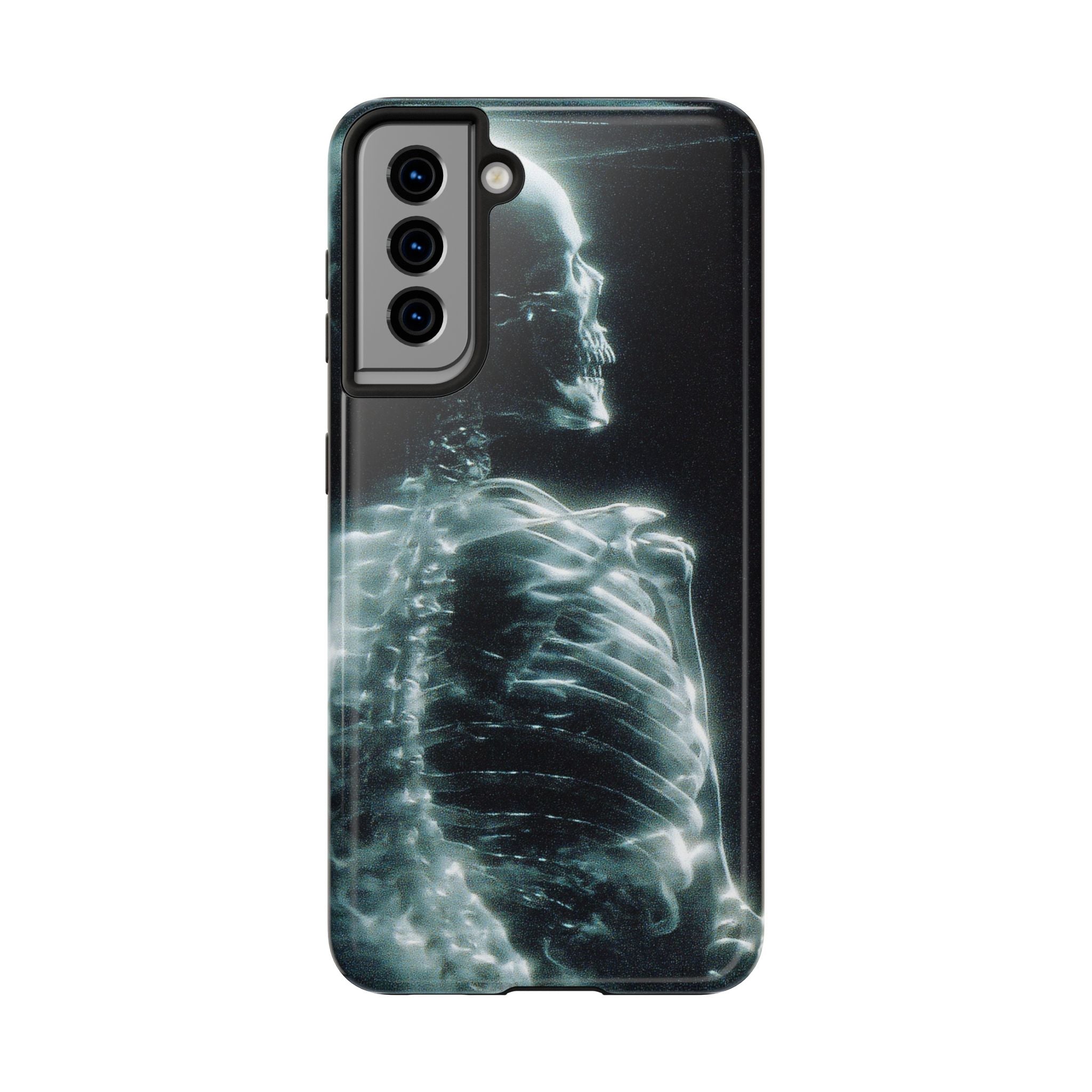 X ray phone case