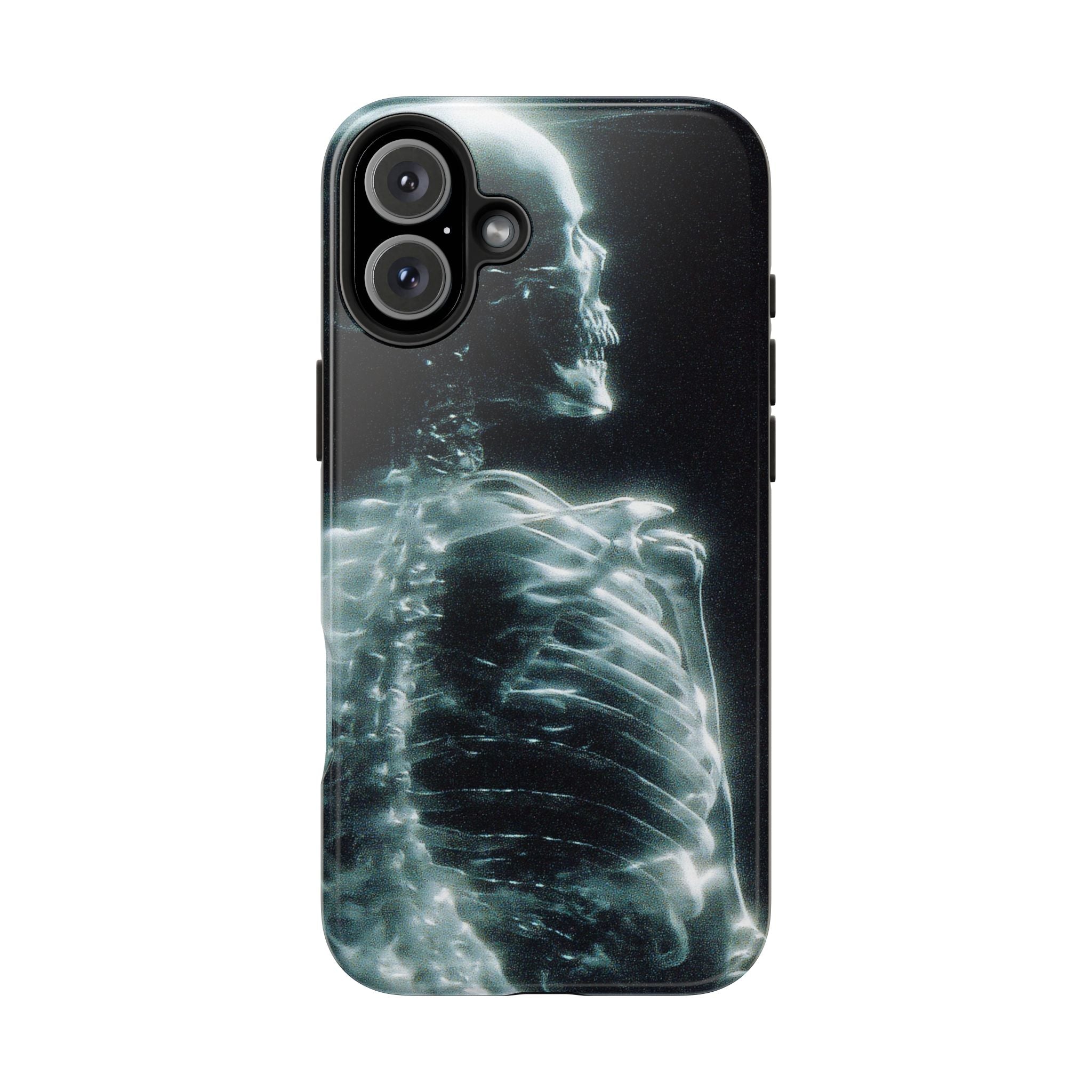 X ray phone case