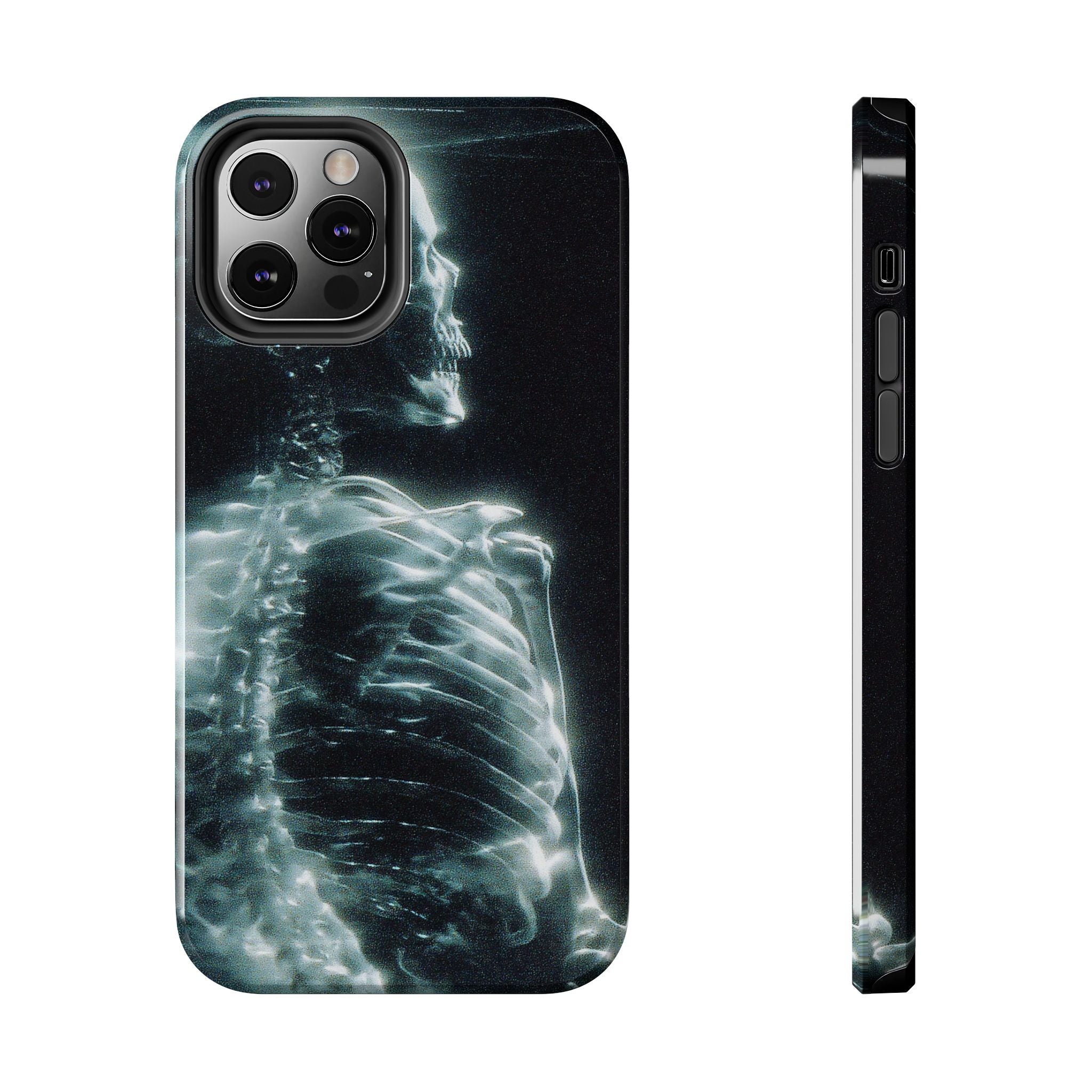 X ray phone case