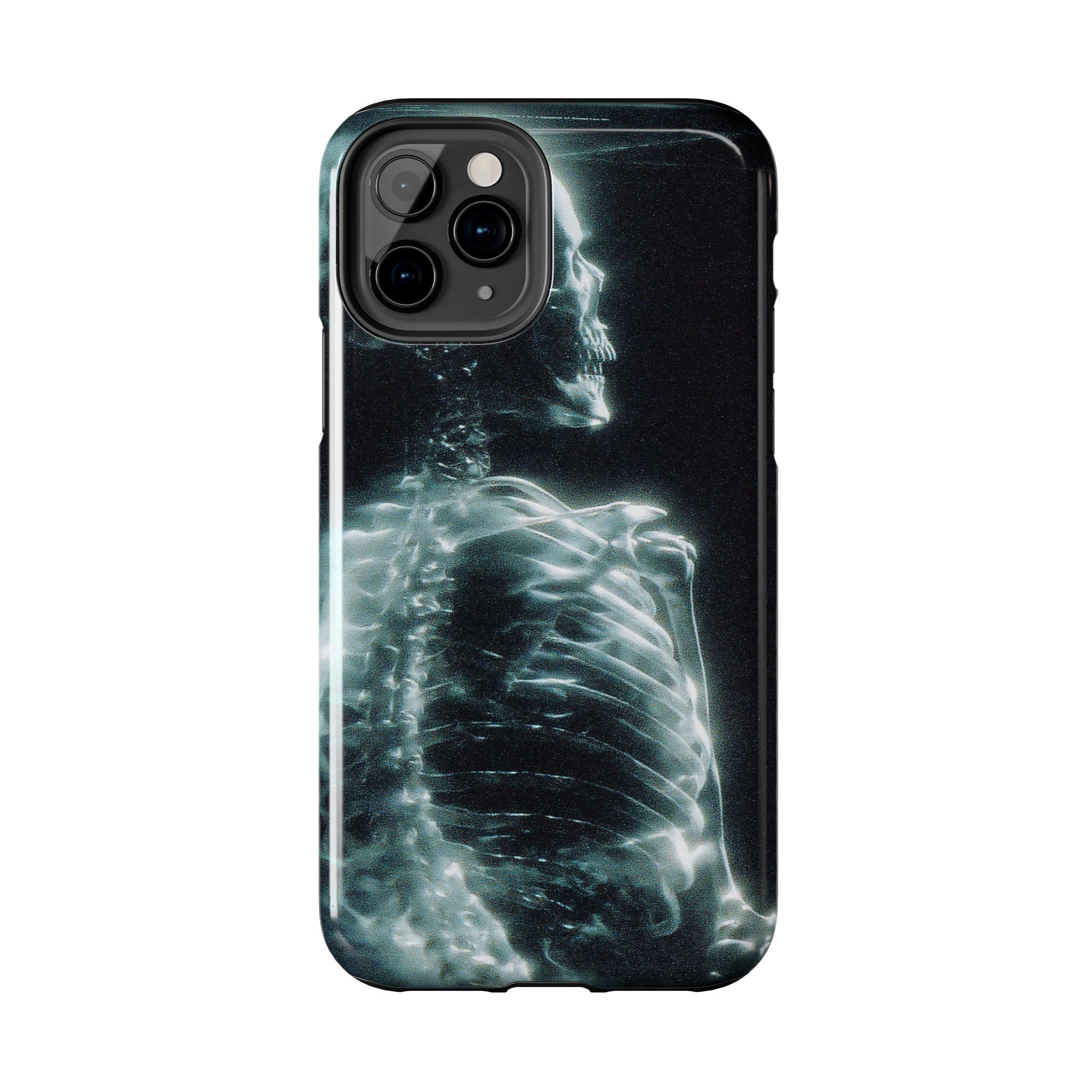 X ray phone case