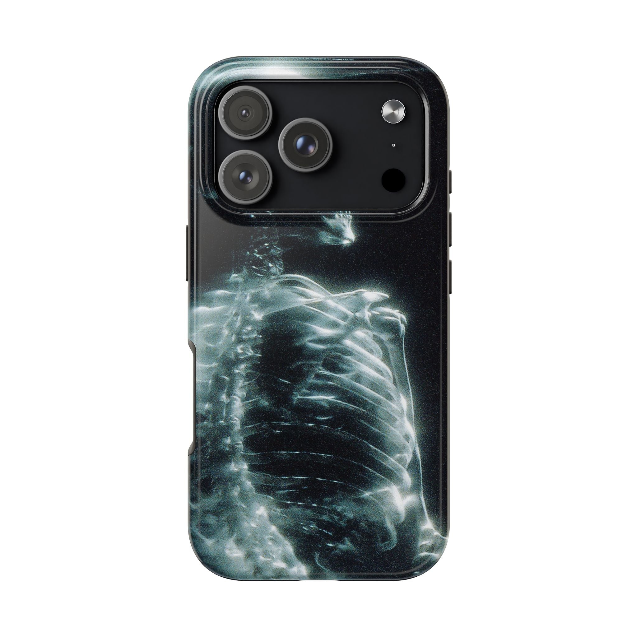 X ray phone case