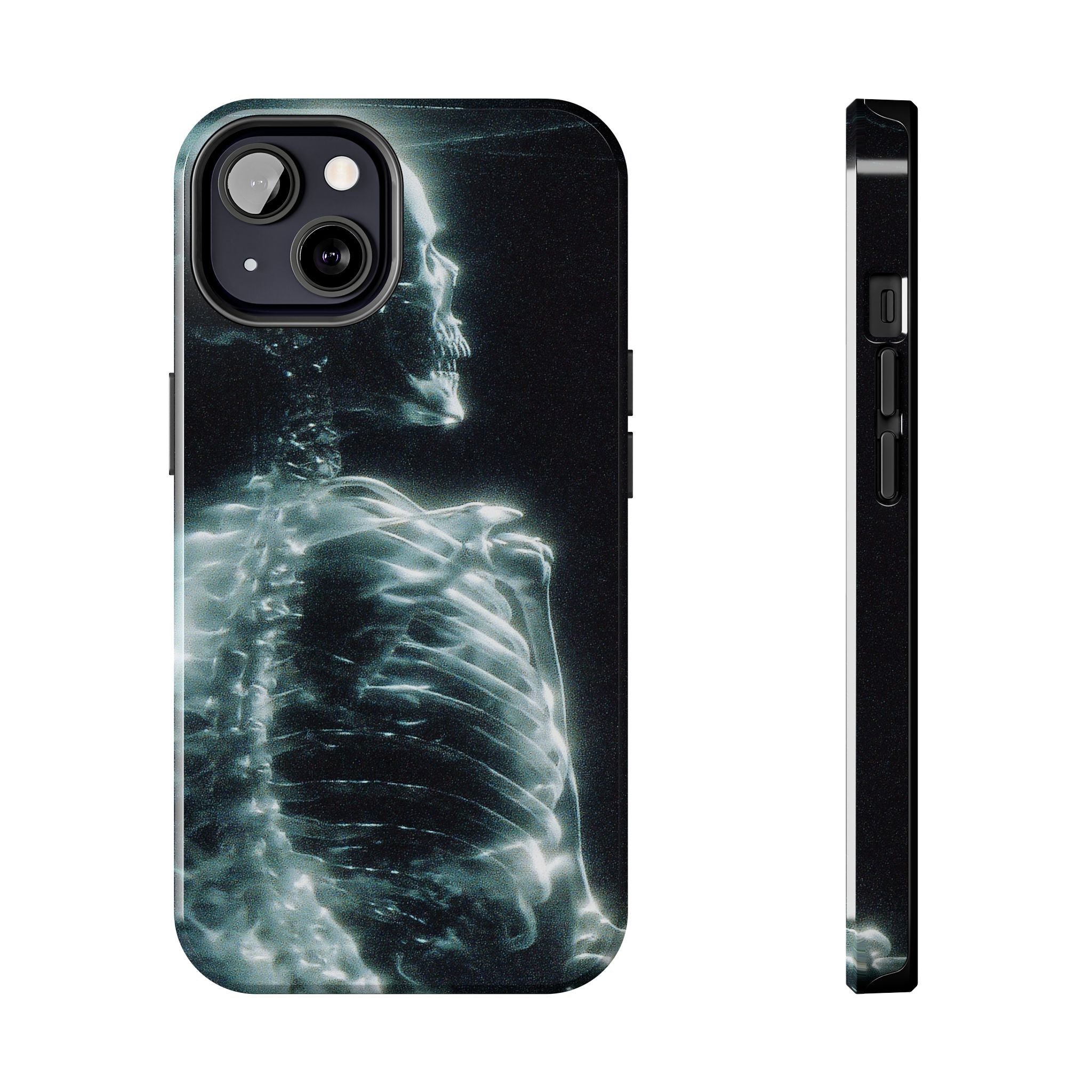 X ray phone case