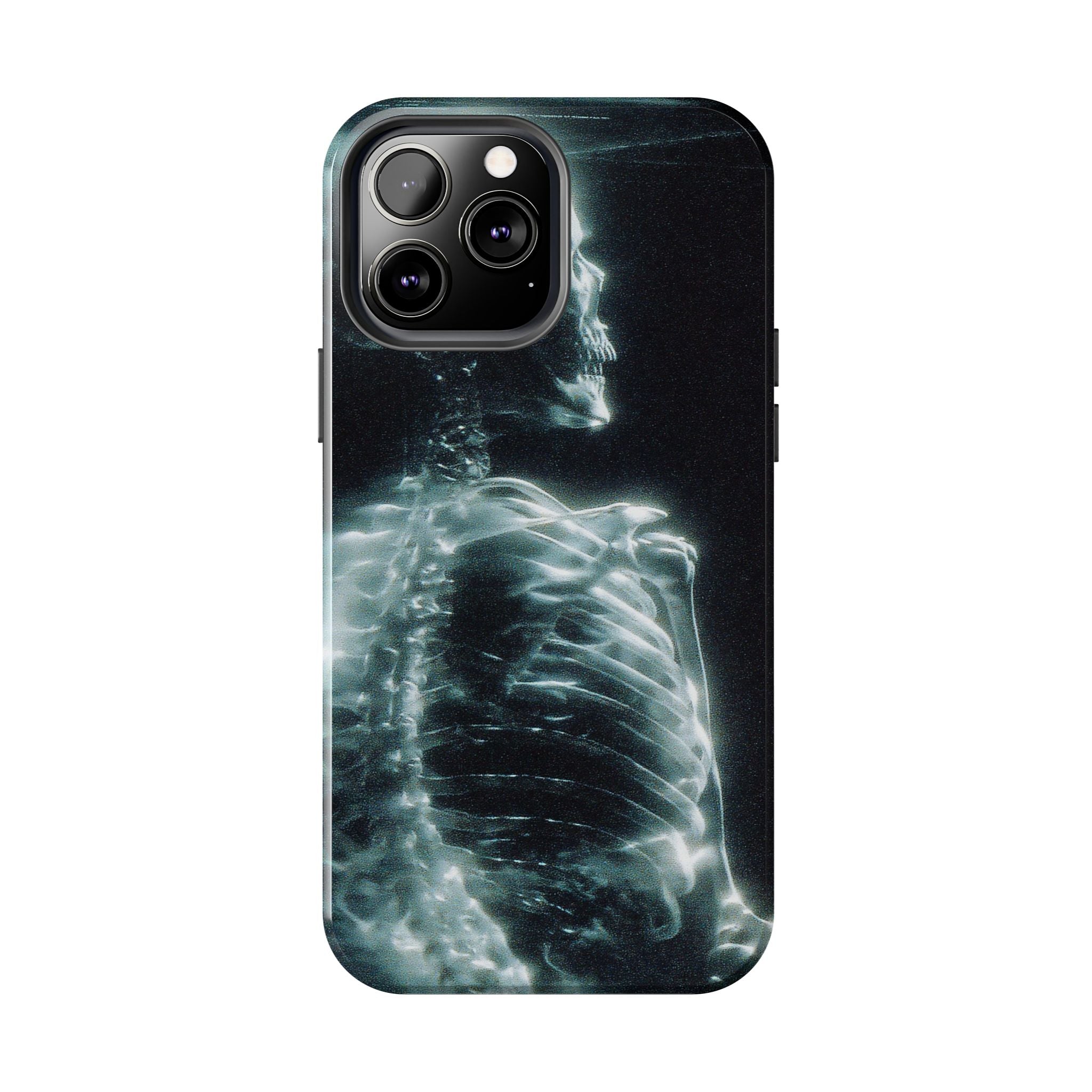 X ray phone case