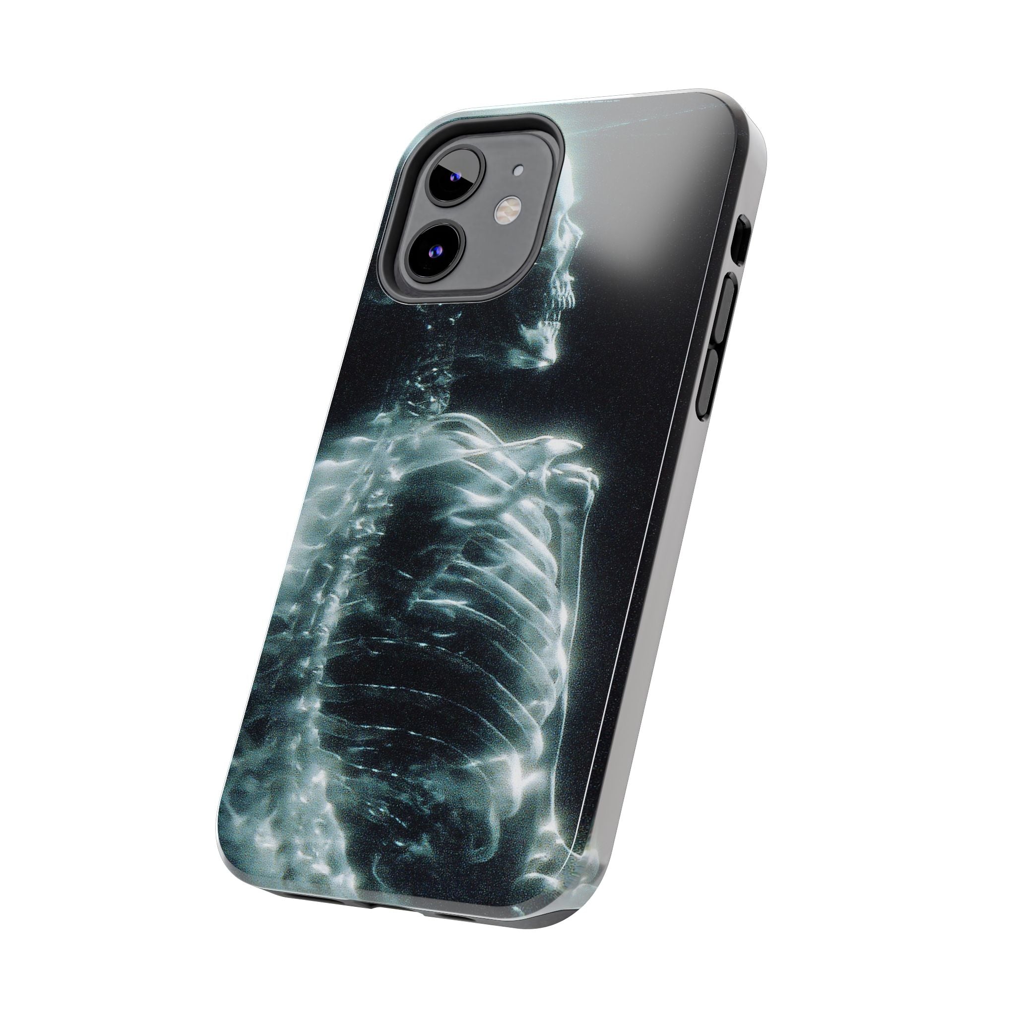 X ray phone case