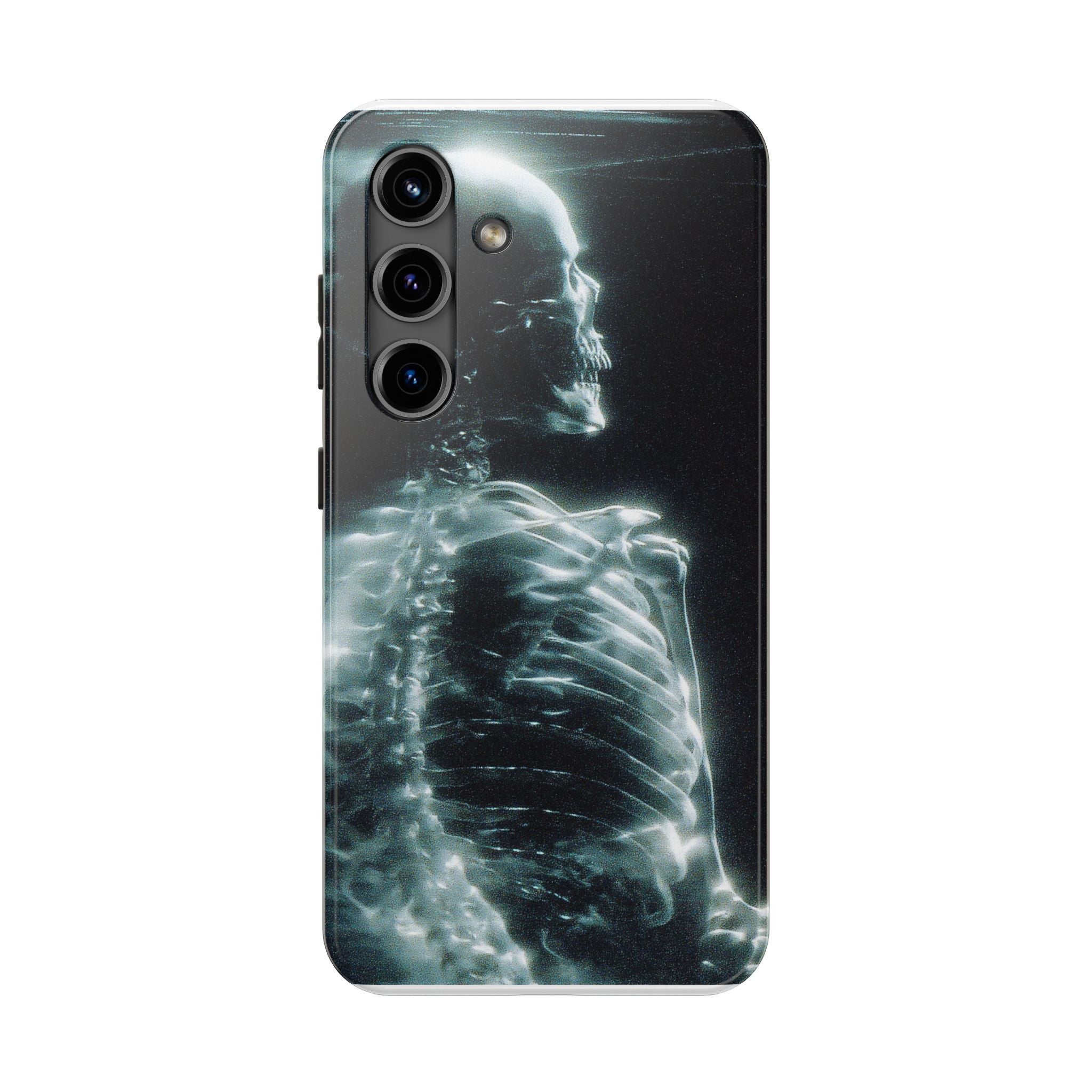 X ray phone case