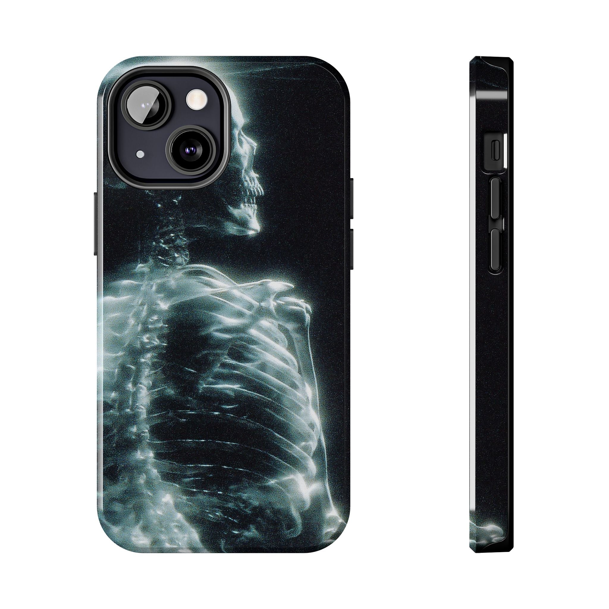 X ray phone case