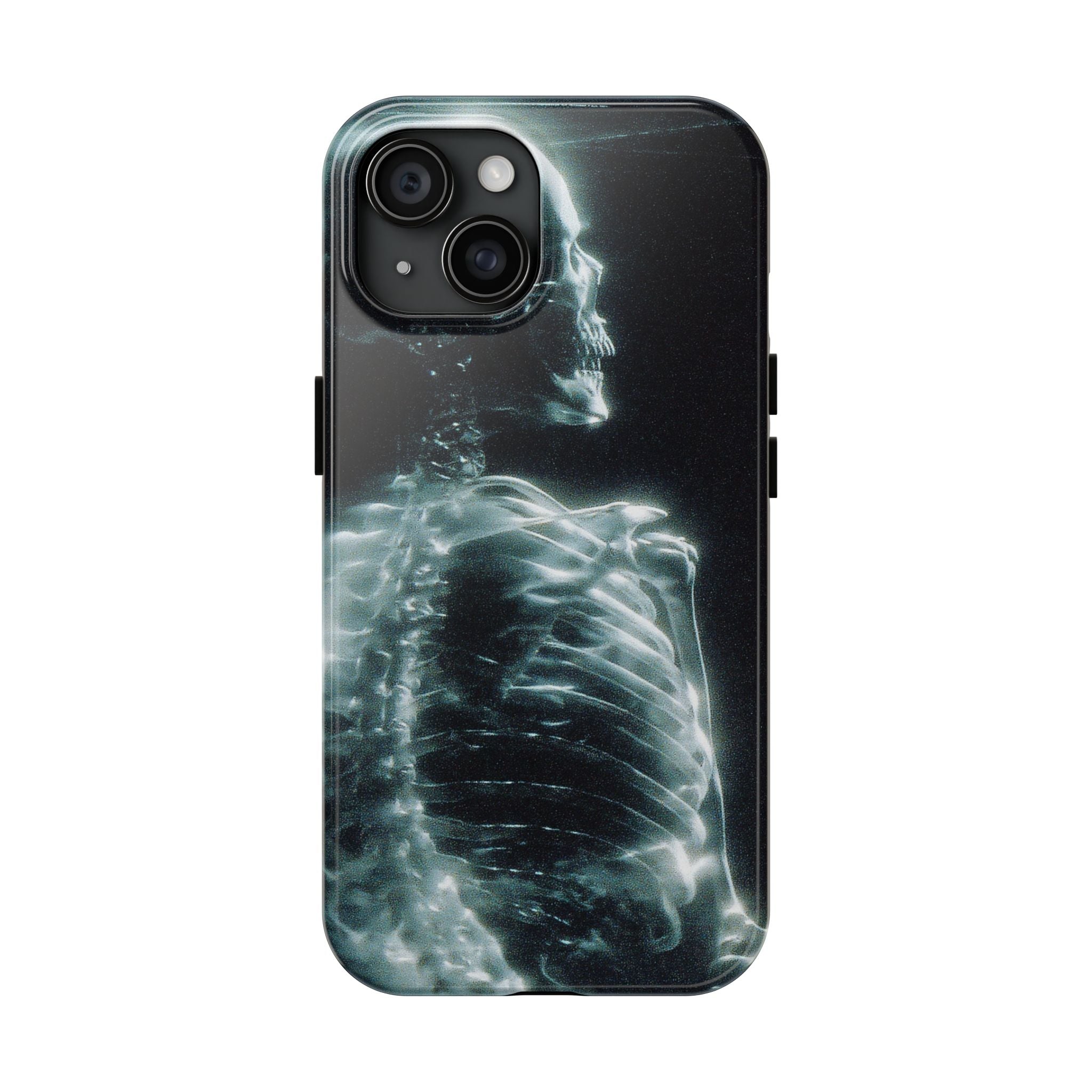 X ray phone case