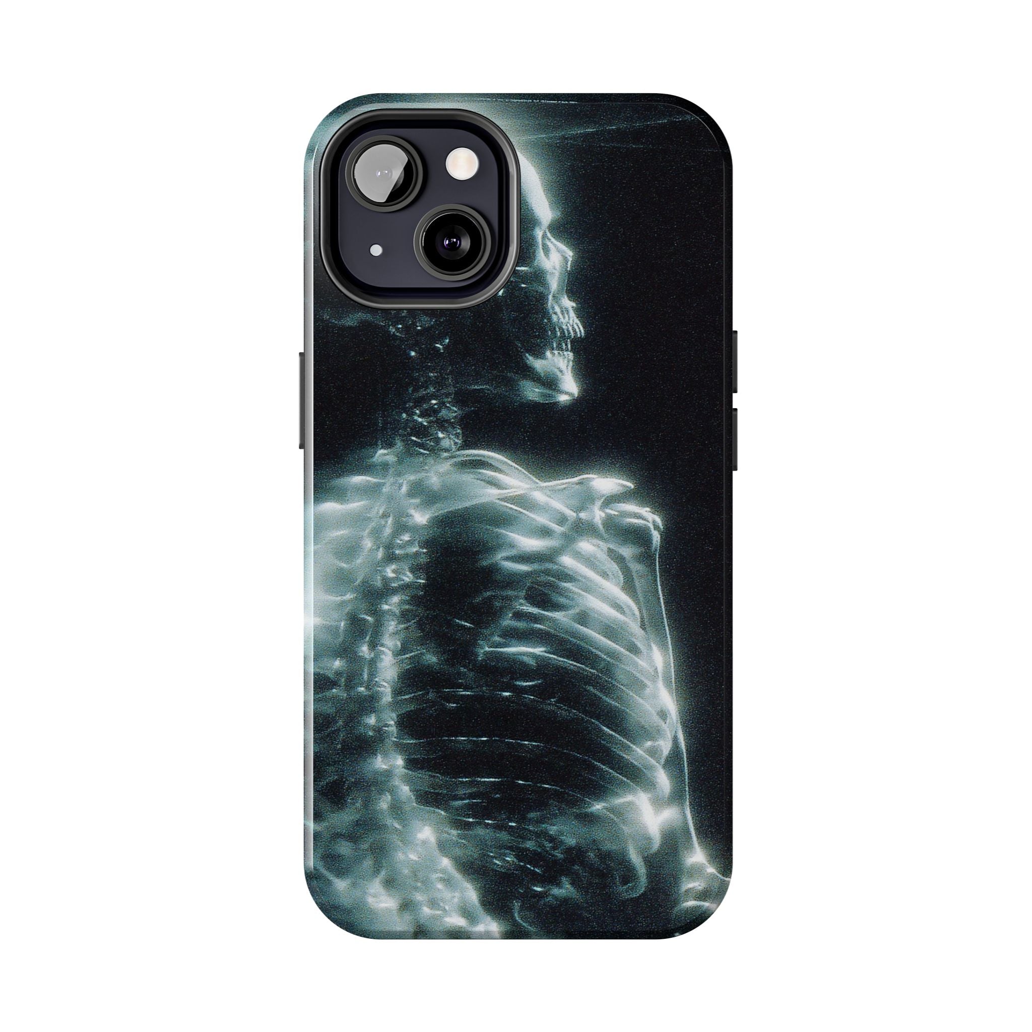 X ray phone case