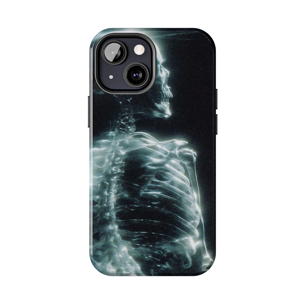 X ray phone case