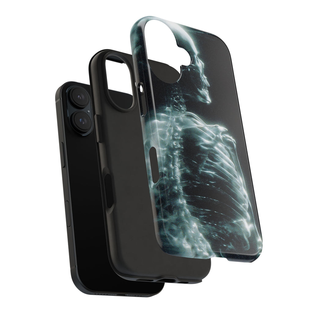 X ray phone case