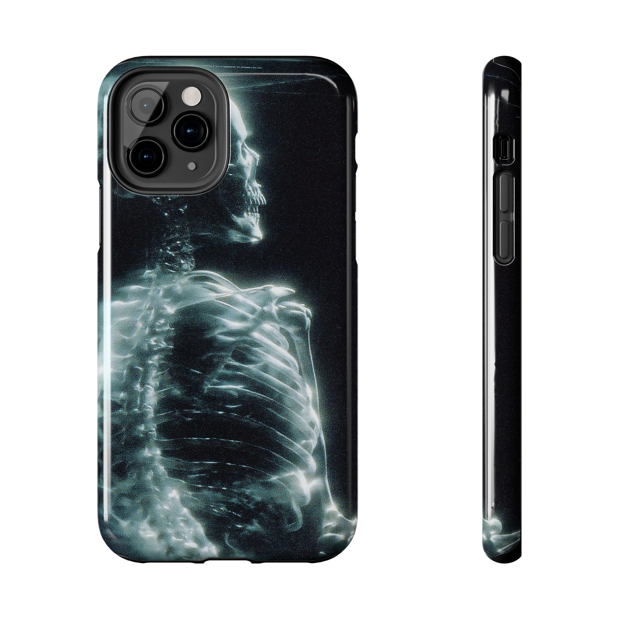X ray phone case