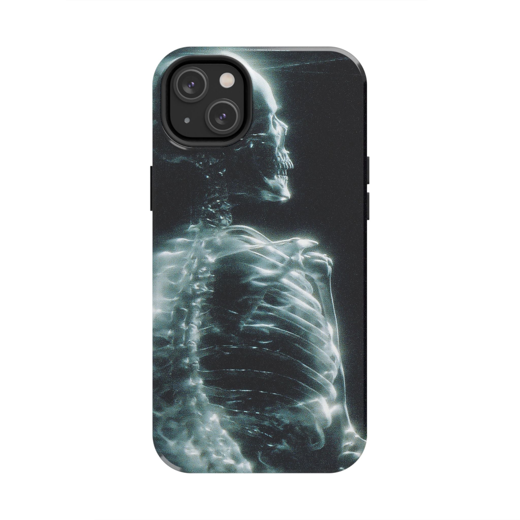X ray phone case