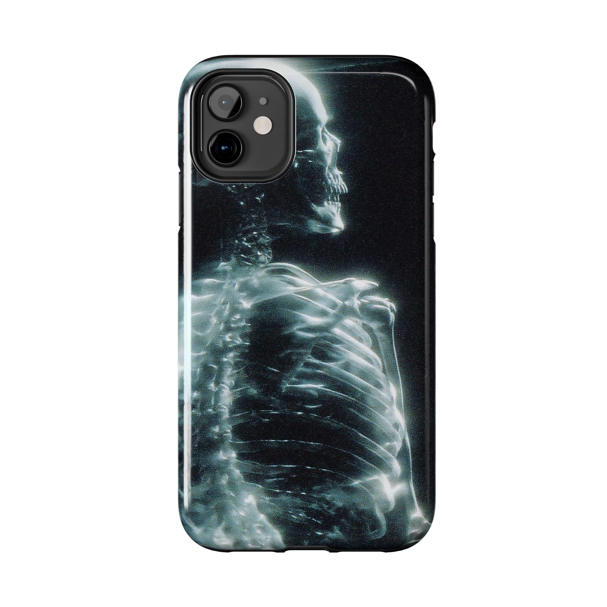 X ray phone case