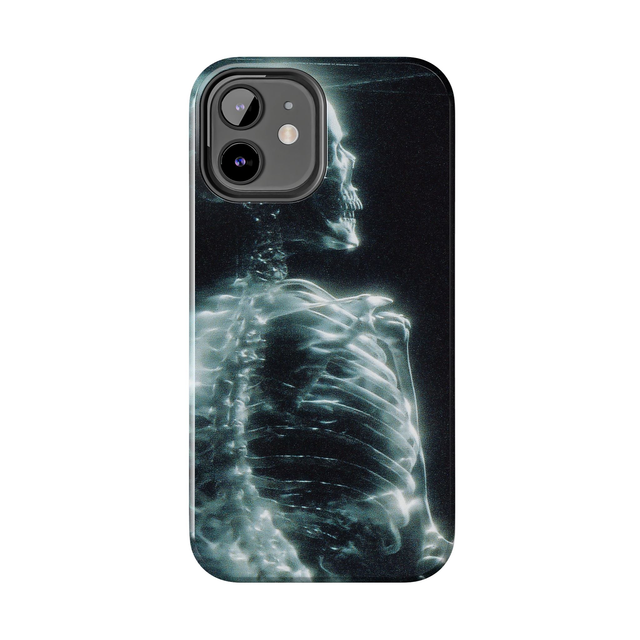 X ray phone case