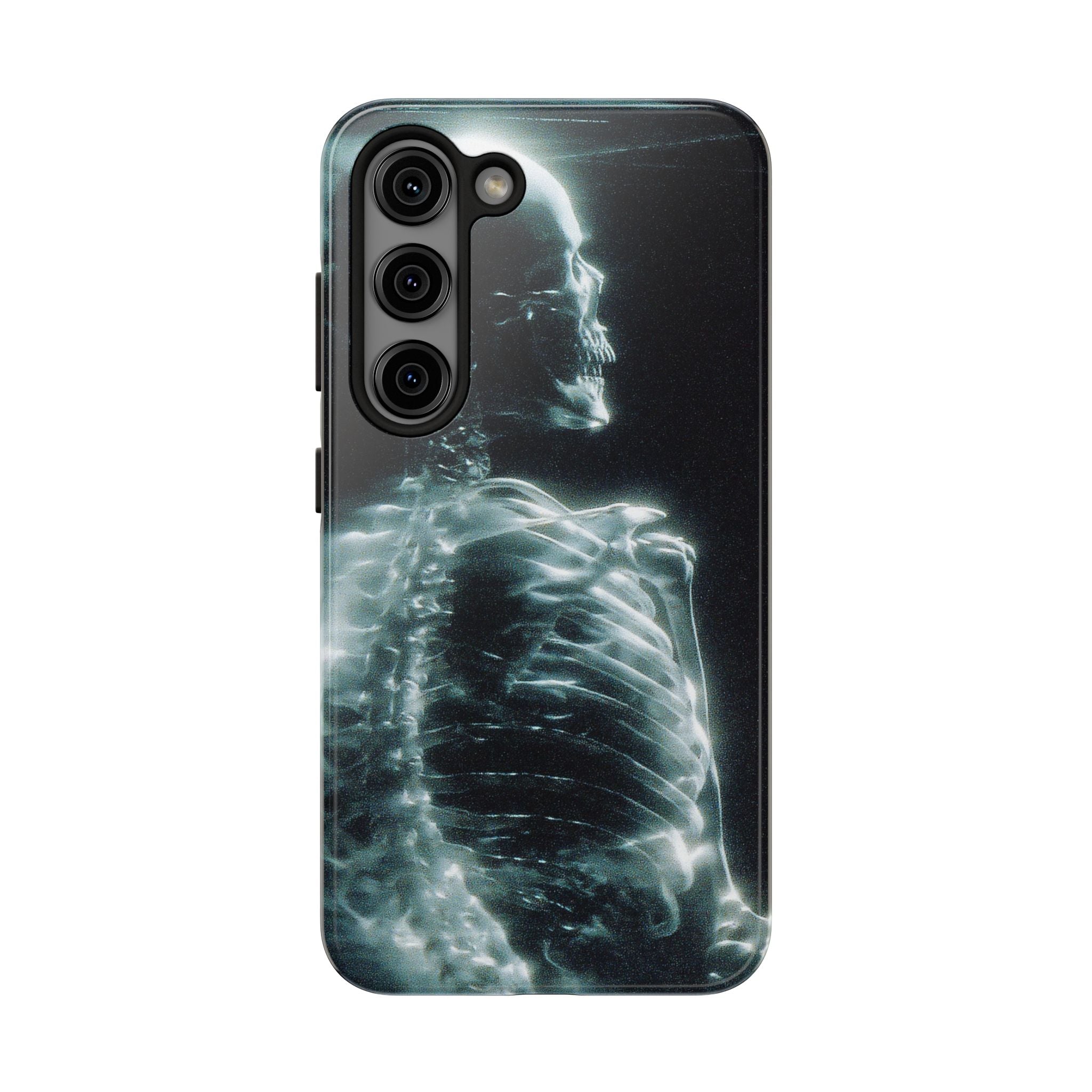 X ray phone case