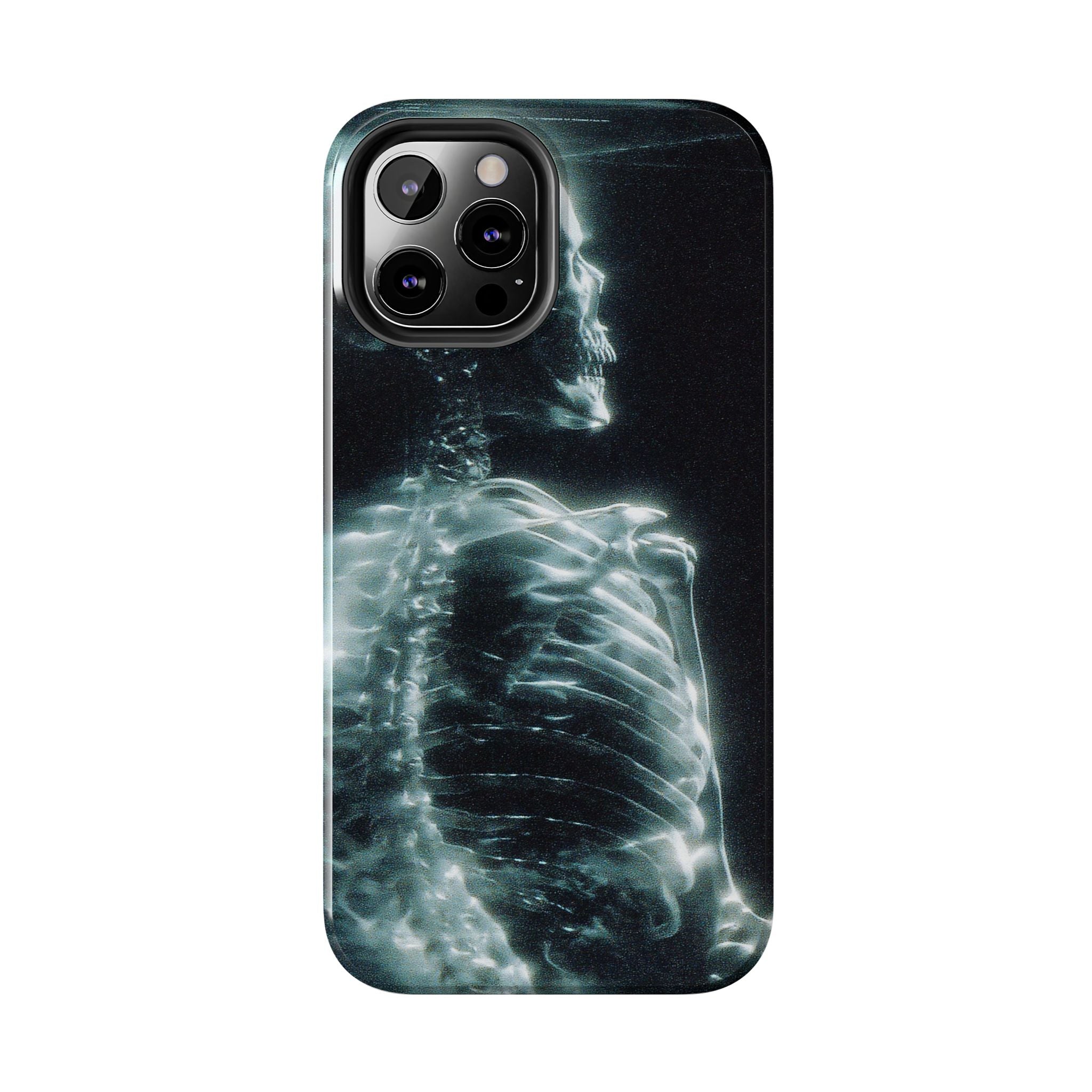X ray phone case