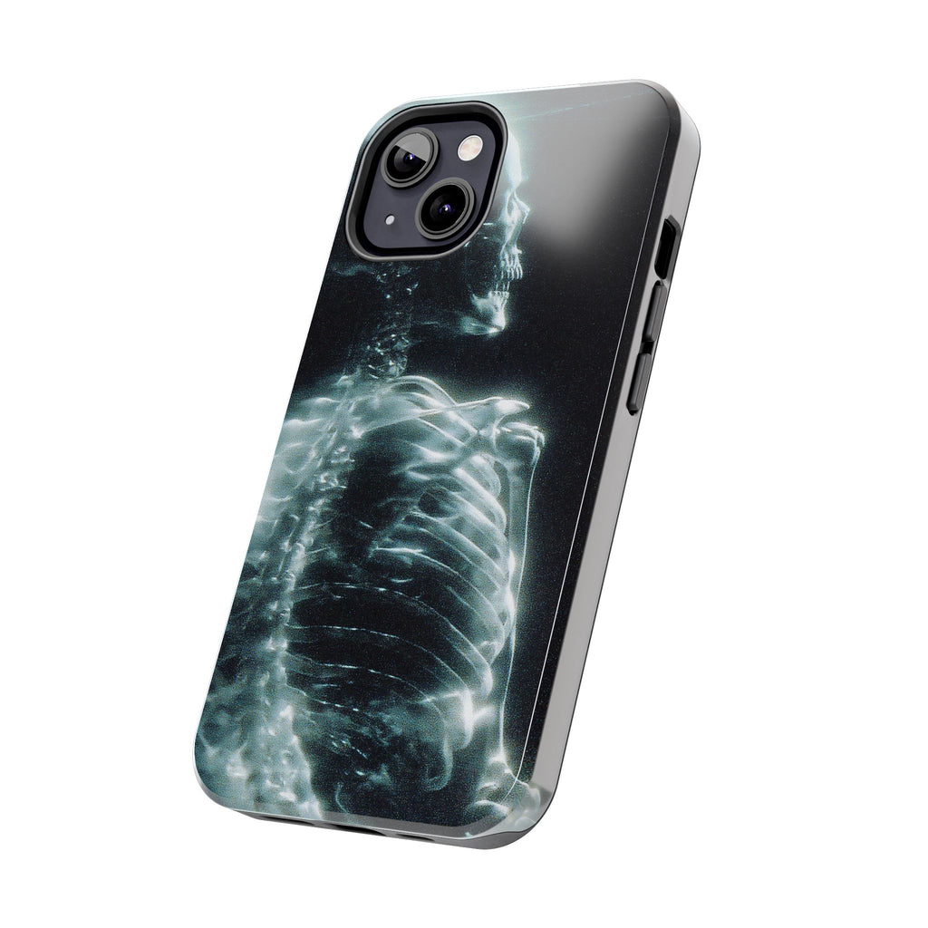 X ray phone case