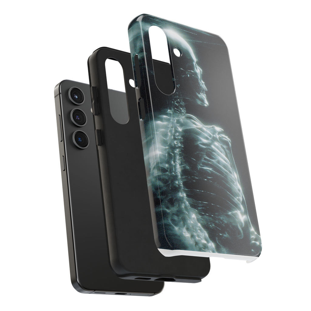 X ray phone case
